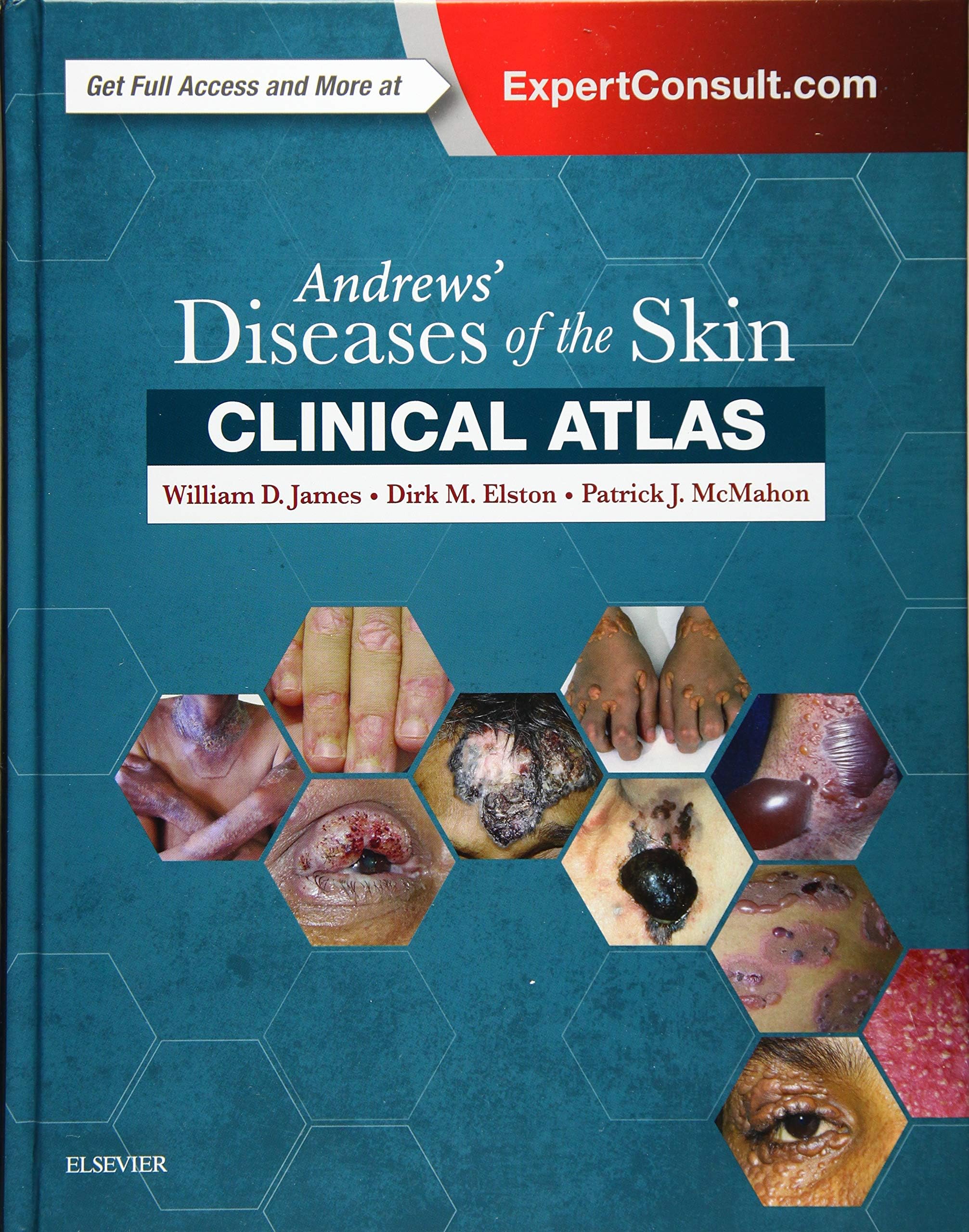 Andrews' Diseases of the Skin Clinical Atlas 1st Edition