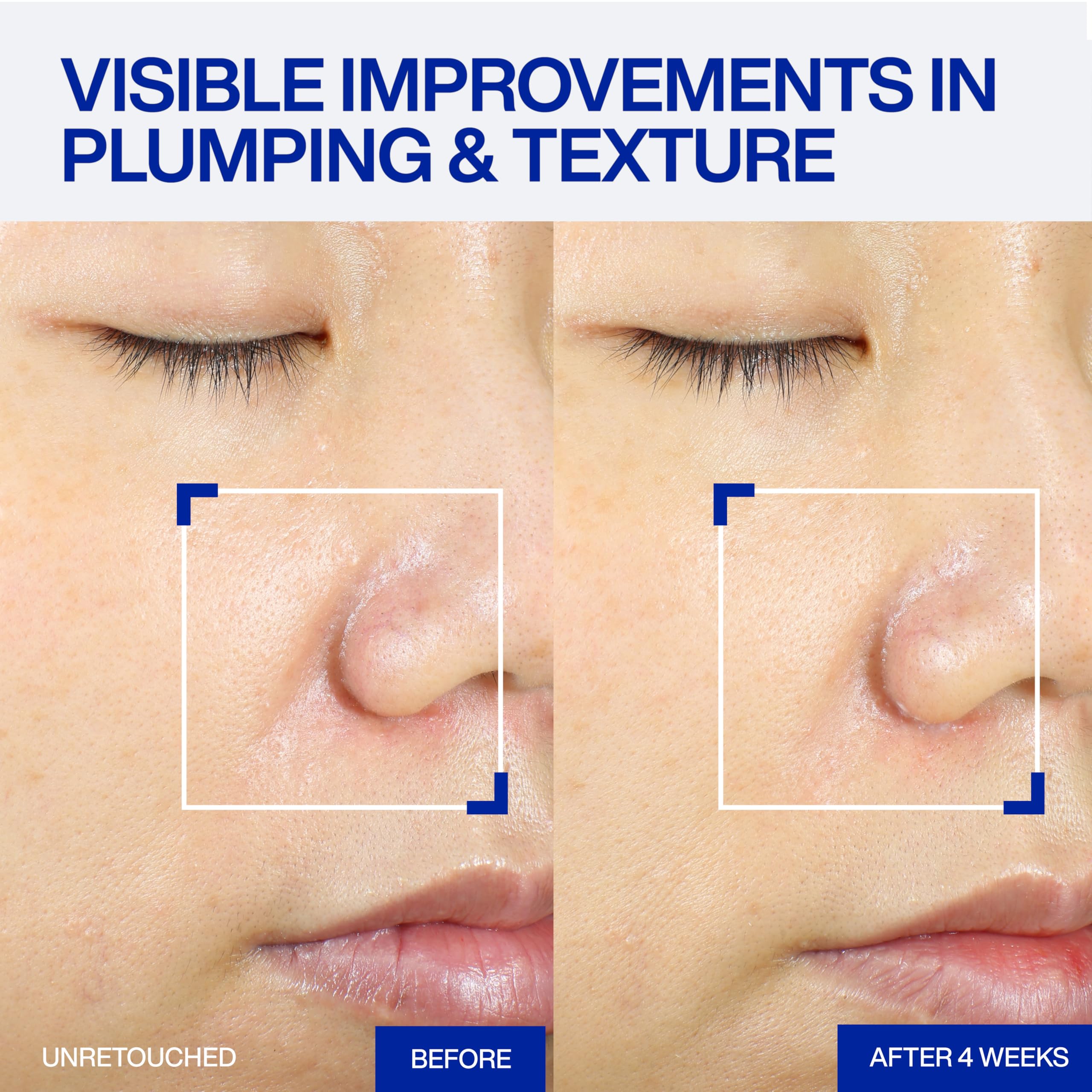 IOPE XMD Stem III Clinical Recovery Serum - Professional PDRN Treatment-Level Results - Visibly Firms, Plumps Volume, and Refines Pores - With Hyaluronic Acid - 1.69 fl. oz.