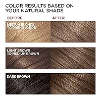 Vista 5 de LOreal Paris Superior Preference Sistema de cuidado