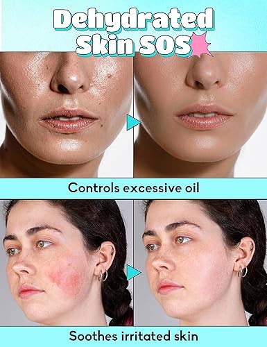 Miniatura 3 de Jericho Rose - Suero hidratante de ácido hialurónico coreano para la cara, suero hidratante para piel seca, suero facial reductor de arrugas para