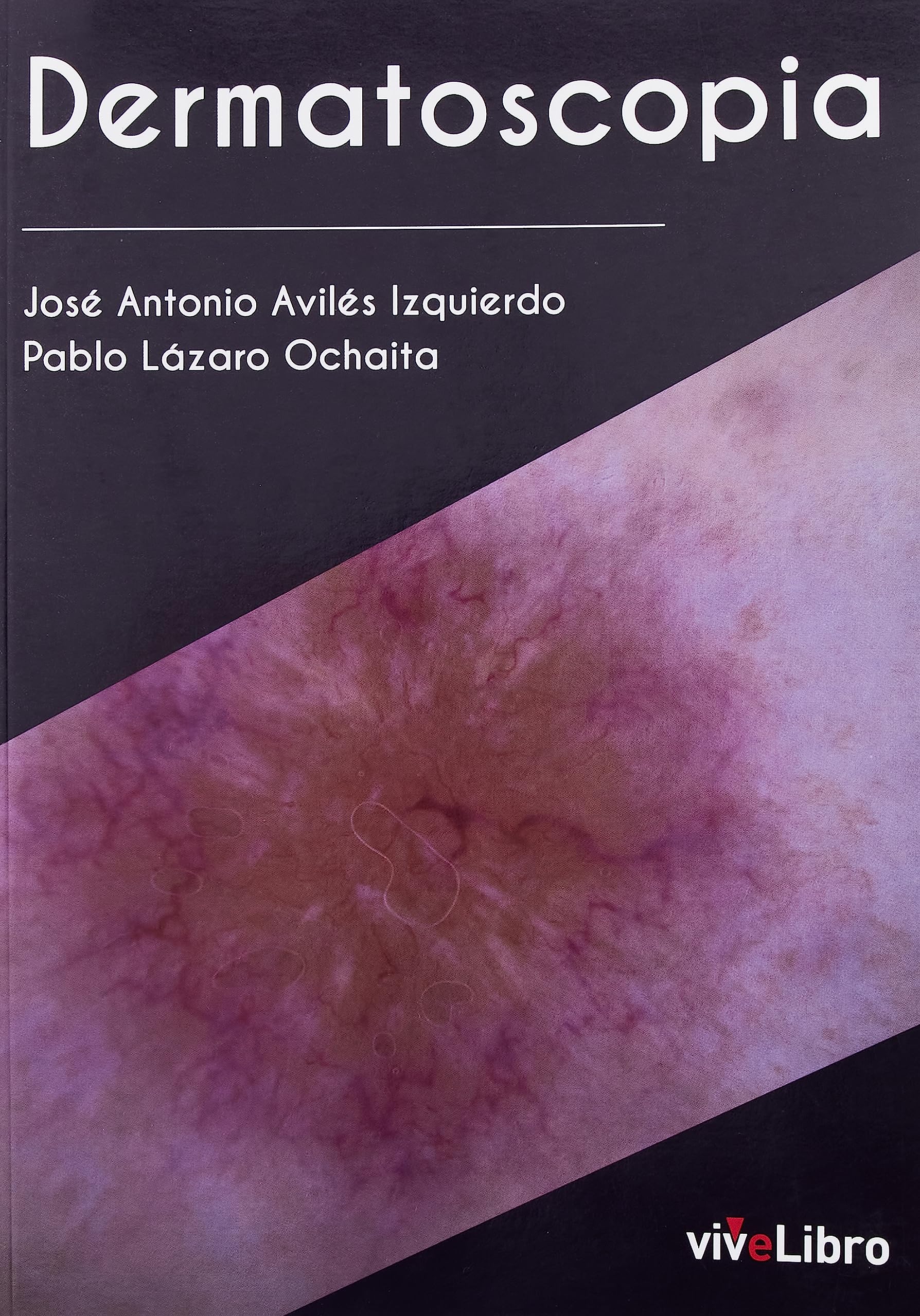 Dermatoscopia (SIN COLECCION)