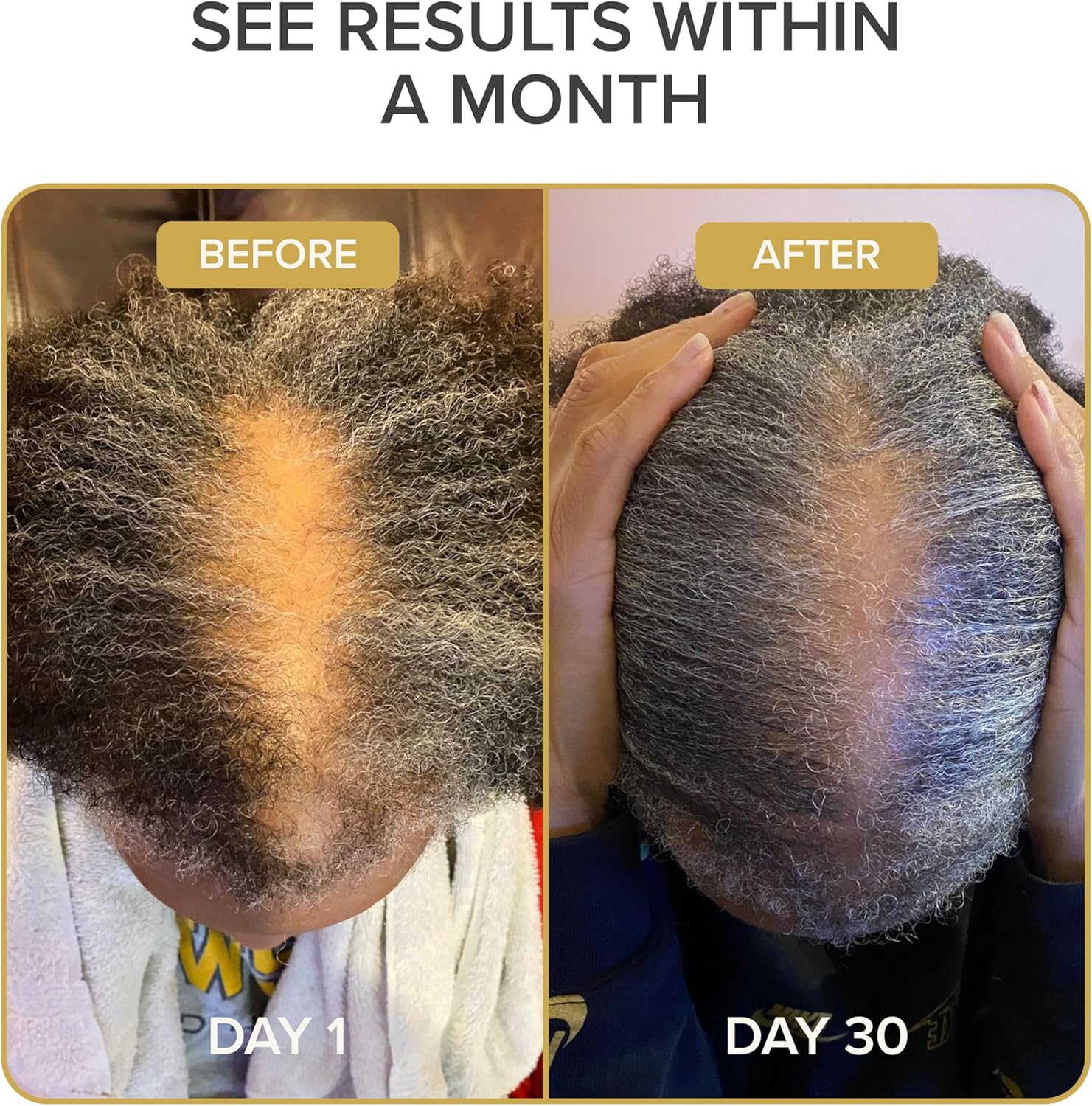 Shedavi Iconic Natural Hair Vitamins for Fast Hair Growth - Pure Hair Supplements Formulated with Vitamins to Promote Thicker, Stronger Hair - Vegan Hair Care for Hair Loss - Non-GMO (60 Capsules) - Image 4