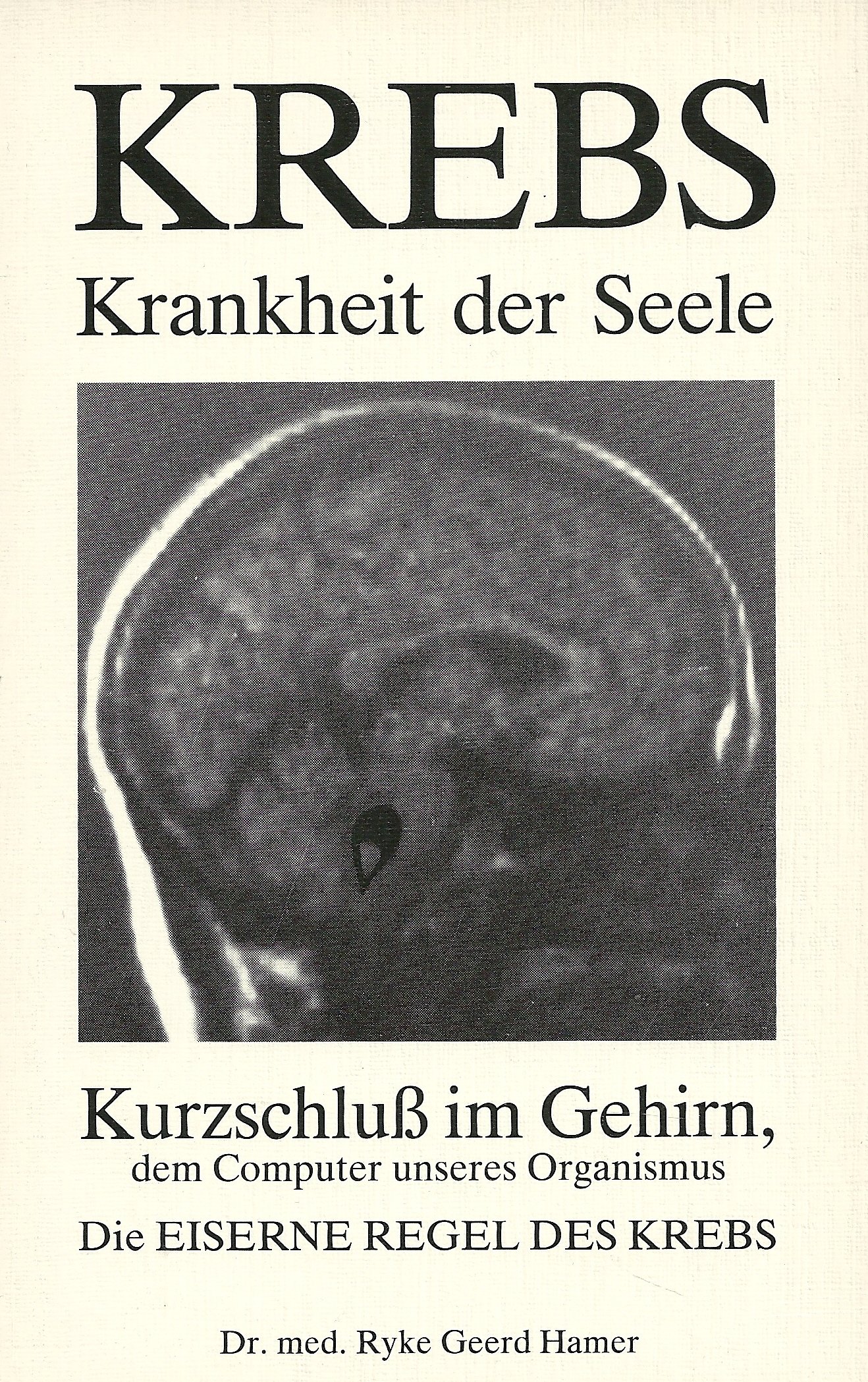 Krebs - Krankheit der Seele. Kurzschluss im Gehirn, dem Computer unseres Organismus. Die Eiserne Regel des Krebses