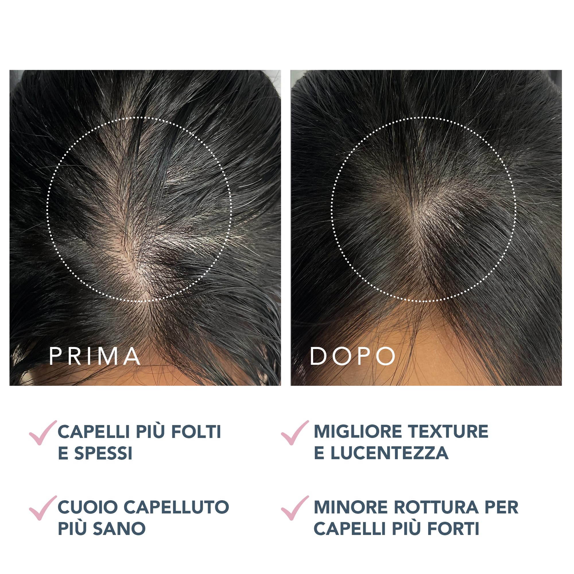 FOREO LUNA - Siero doppio peptide per la crescita dei capelli e trattamento del cuoio capelluto con complesso peptidico, Cica & Portulaca, siero per la crescita dei capelli, trattamento contro la