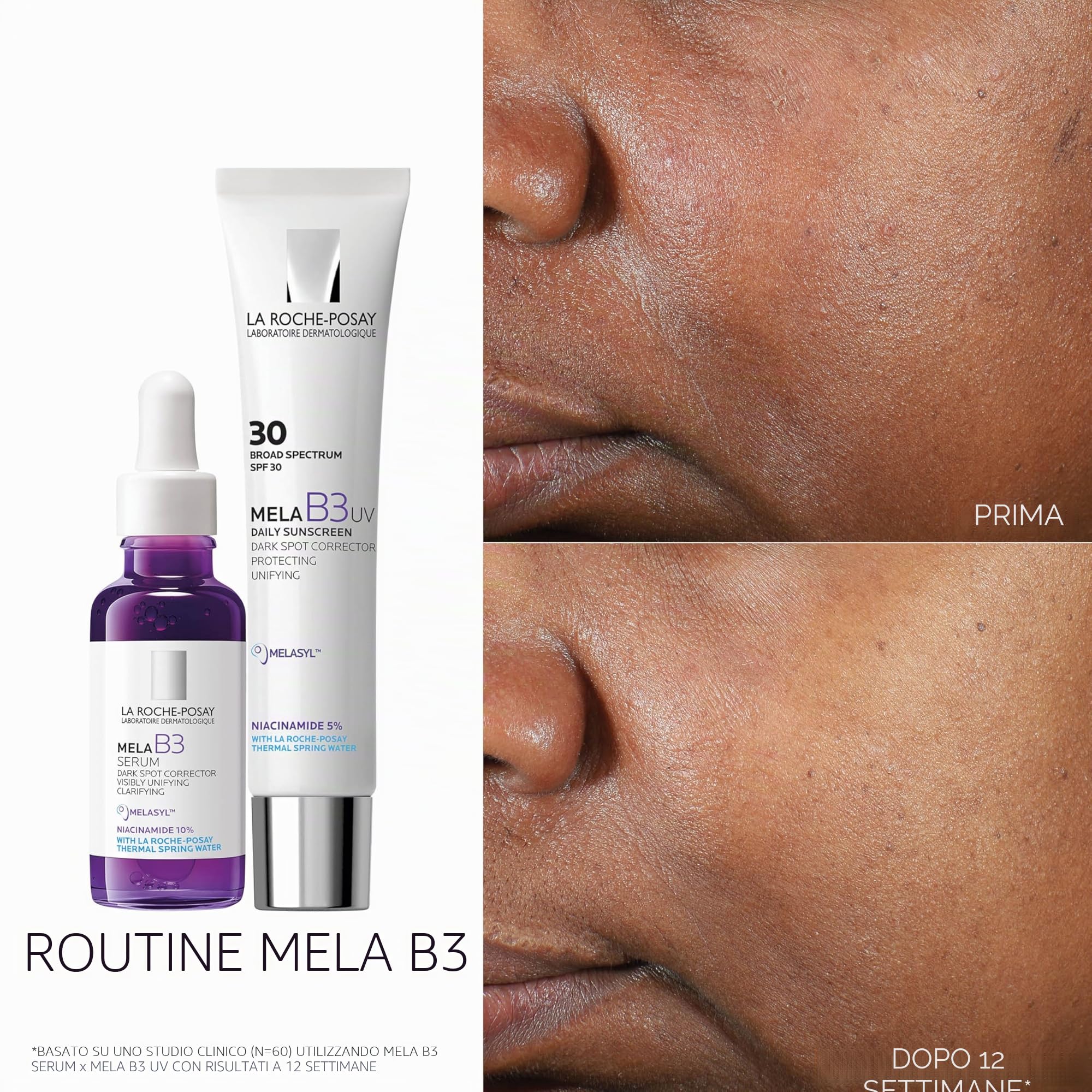 La Roche Posay Mela B3, Siero Intensivo Concentrato Anti-Macchie, Per Tutti i Tipi di Pelle, Azione Anti-Ricomparsa, Incarnato Più Luminoso e Uniforme, Arricchito con Melasyl e Niacinamide, 30 ml