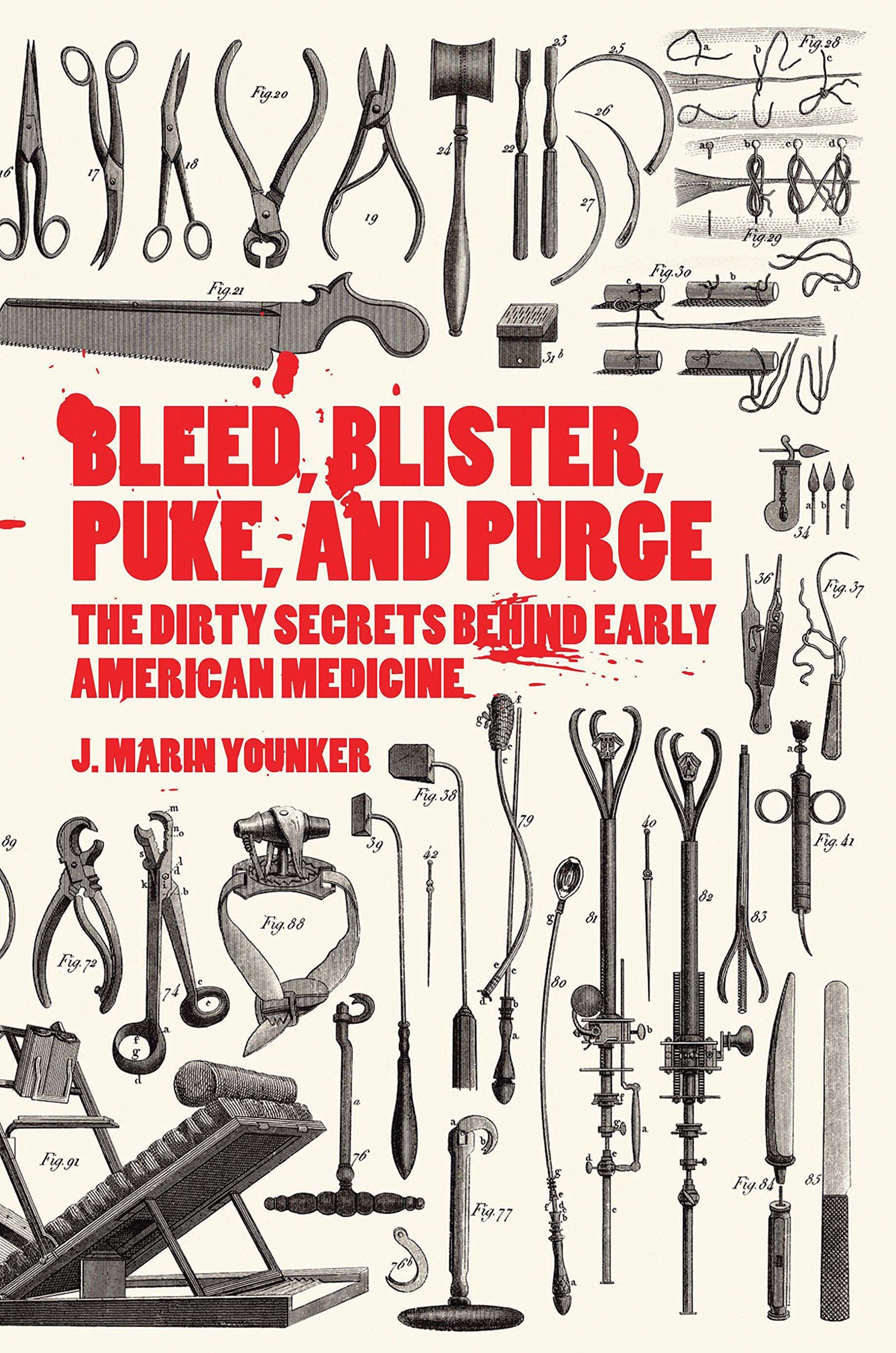 Buy Bleed, Blister, Puke, and Purge: America s Medical Middle Ages — BookShops.in