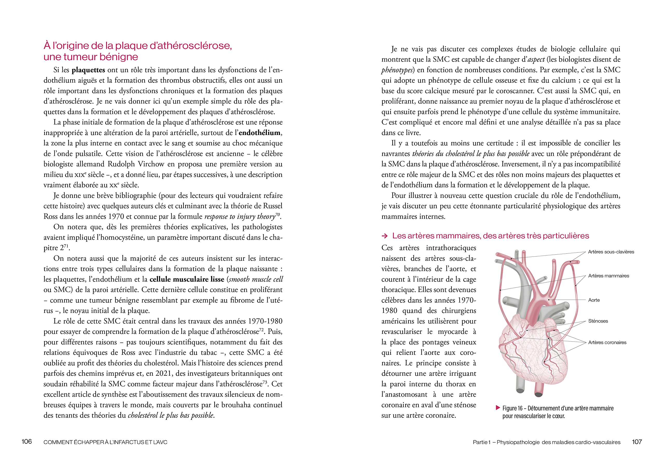 Comment échapper à l'infarctus et l'AVC