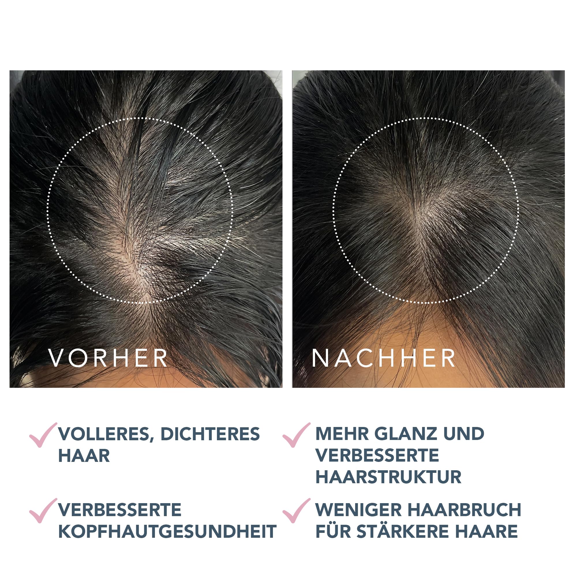 FOREO LUNA Dual-Peptid-Kopfhautserum - Haarwachstumsserum & Kopfhautbehandlung mit Peptidkomplex, Cica & Portulak - Haarserum für Haarwachstum, Behandlung gegen Haarausfall - 60ml | Kopfhautserum, Haarwachstumsserum, Dual-Peptid, Cica, Portulak, Haarverdi