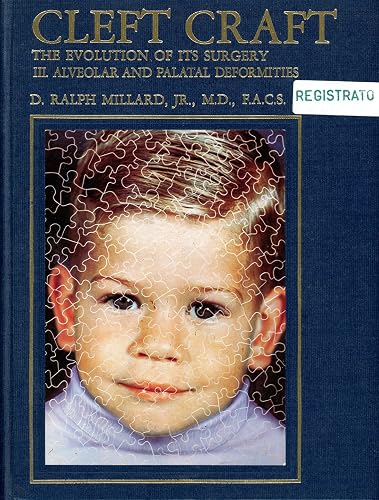 Cleft Craft: Alveolar and Palata and Deformities (Cleft Craft: The Evolution of Its Surgery)