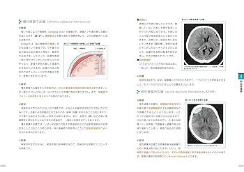 神経内科学の講義がそのまま本になりました。 | 村川 裕二 |本