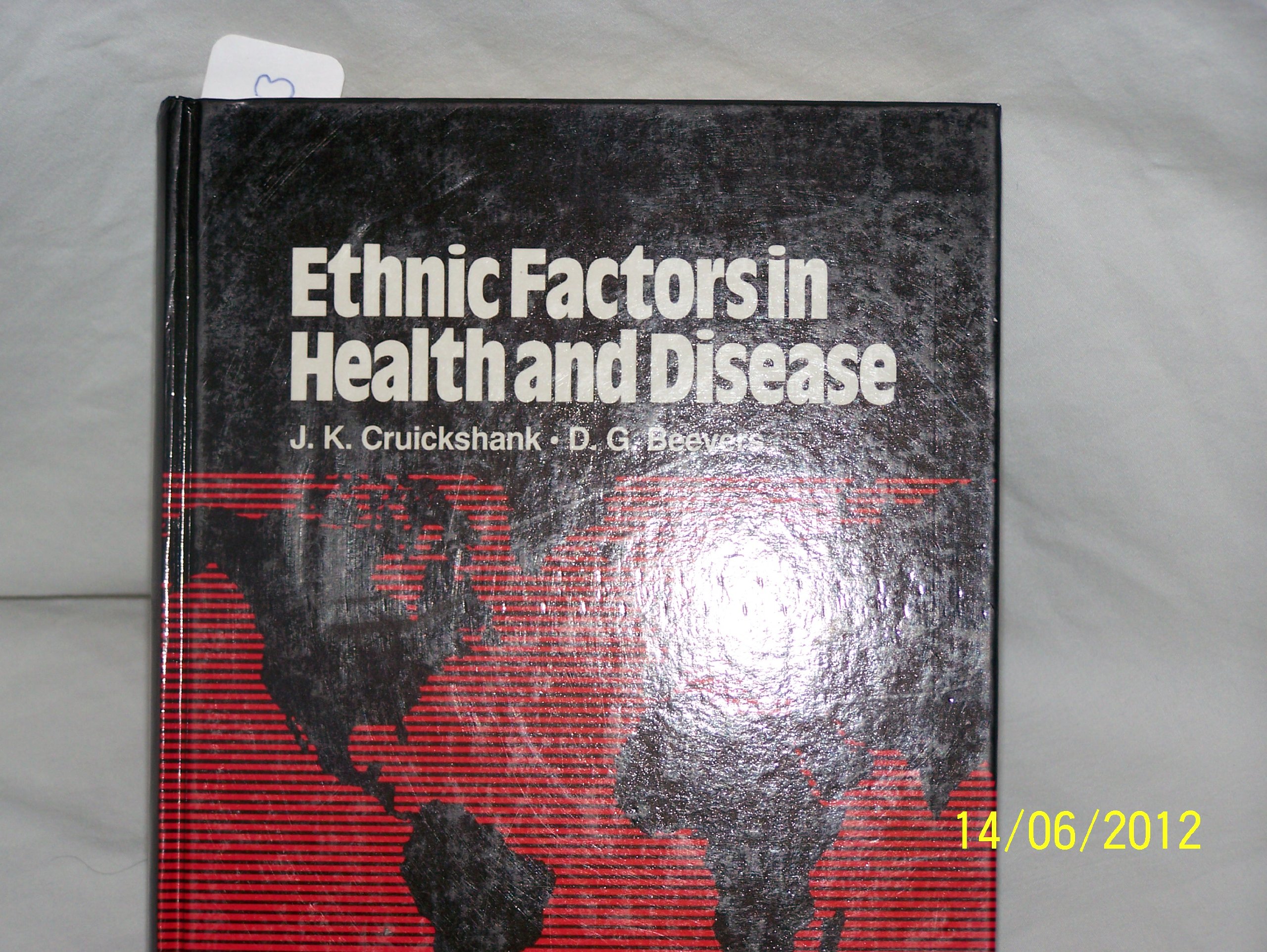 Buy Ethnic Factors in Health and Disease — BookShops.in
