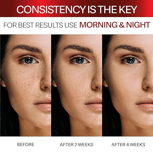 Miniatura 5 de Removedor de manchas oscuras para cara y cuerpo áreas íntimas y sensibles