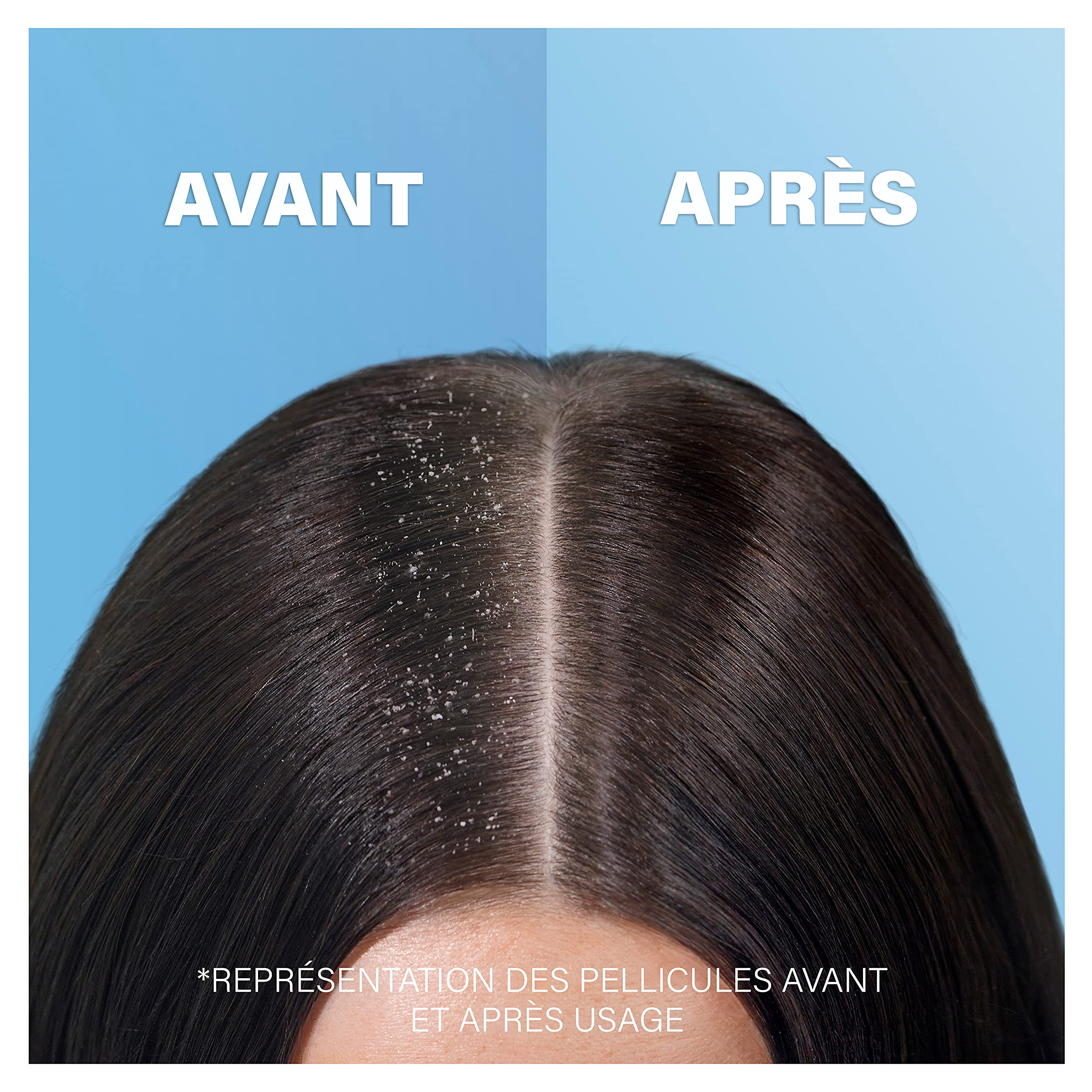 Head & Shoulders, Antiprurito 2 in 1 Shampoo antiforfora e balsamo per prurito legato alla x pellicole, deterge e lenisce la tua pelle capelu, Formula 2 x 270 ml