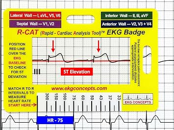 R-CAT EKG Badge