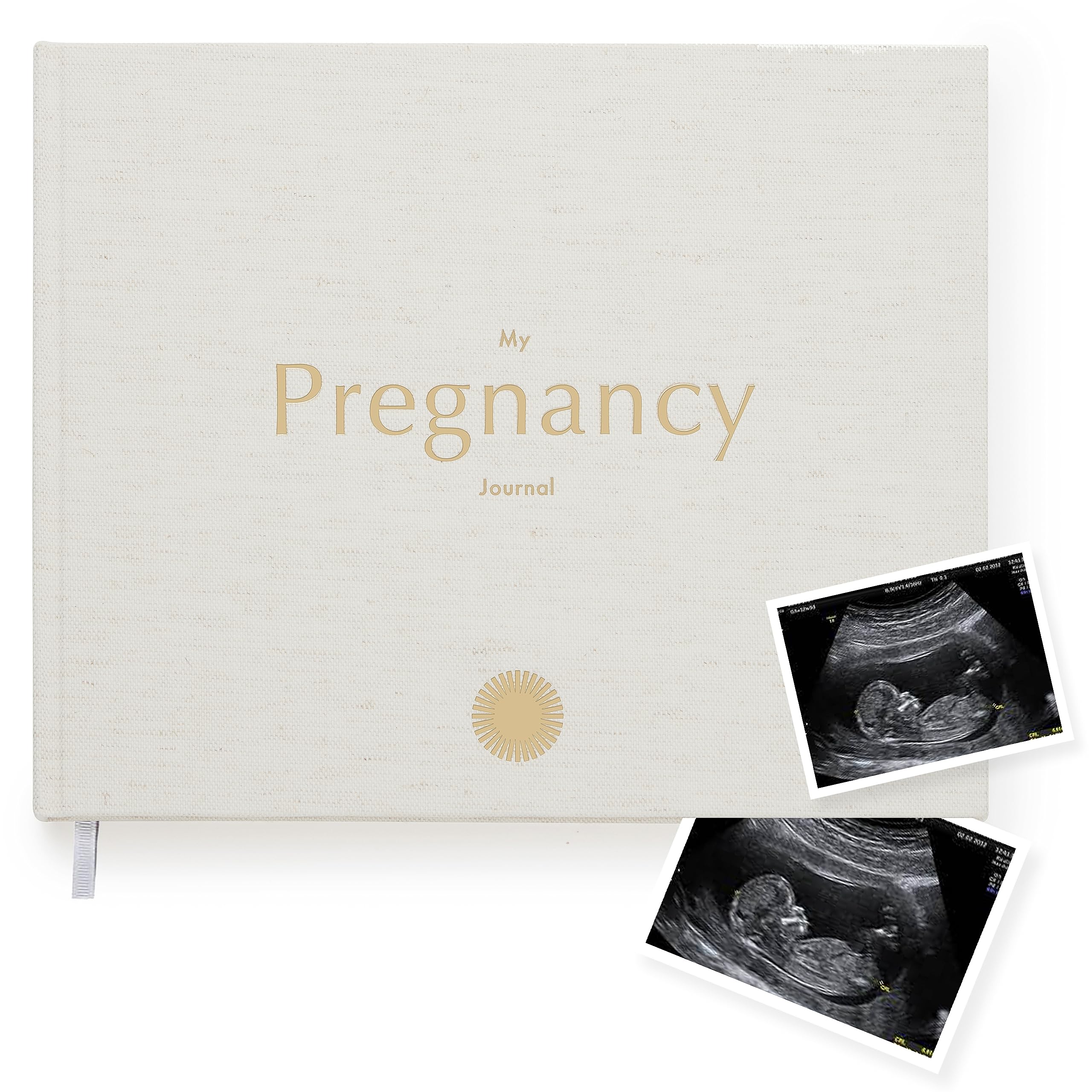 Your Edition Pregnancy Journal - Baby Memory Book for Expecting Mums - Luxury Pregnancy Book - Planner Pregnancy Gift for First Time Parents with Checklist and Photo Section - Gift Boxed Gold Foil