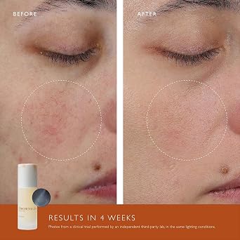 Omorovicza Elixir Serum 1.0 oz, Instant Face Lift, Radiance Booster