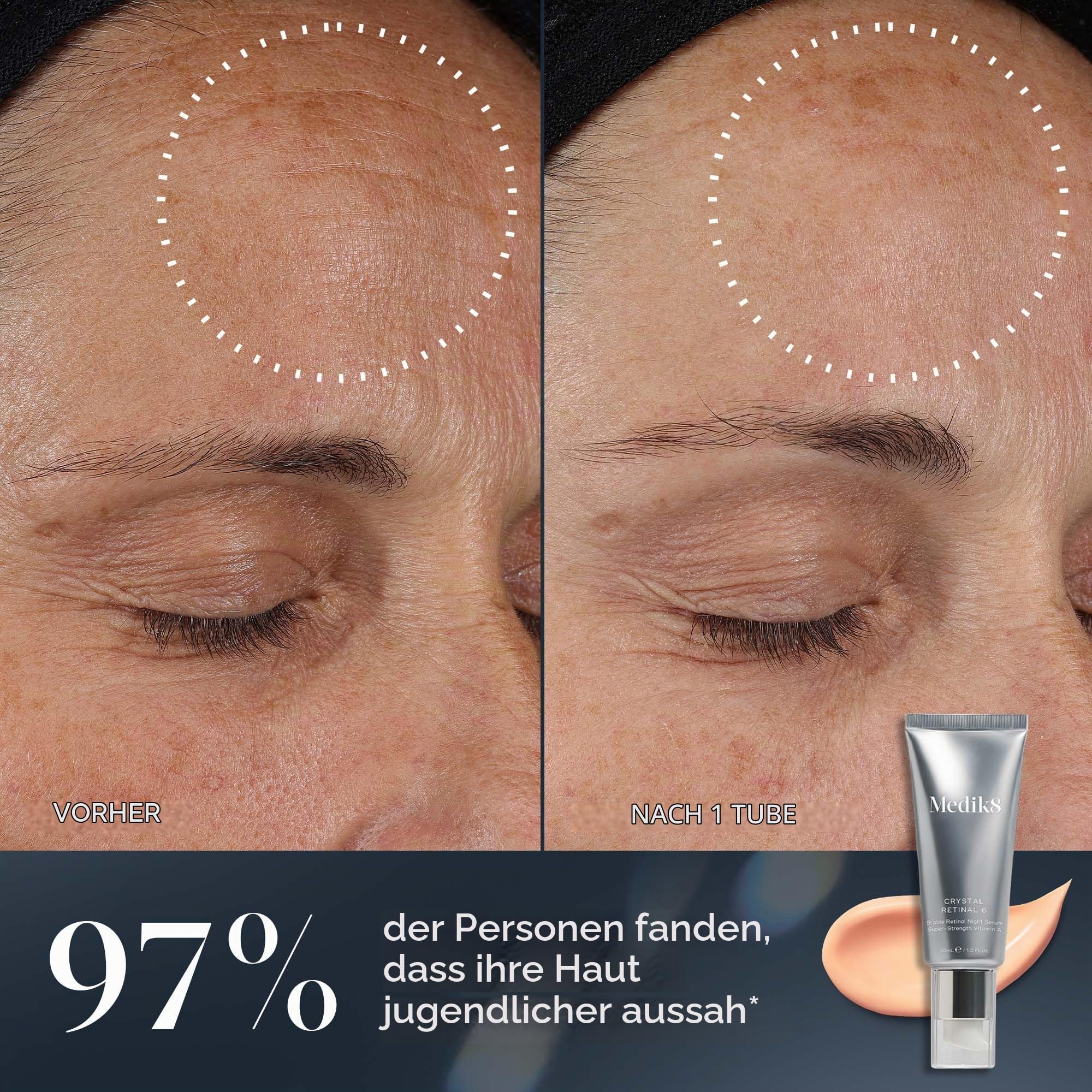 Medik8 Crystal Retinal 20 - Age-Defying Retinal Nachtserum - Verbessert Faltenbild - 0.2% Retinalstärke - 11-mal schneller als Retinol - Für sehr erfahrene Vitamin-A-Anwender - 30ml