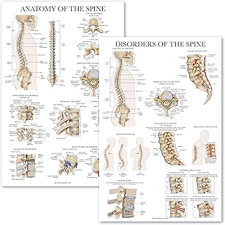 Palace Learning 2 Pack: Anatomy of the Spine + Disorders of the Spine Poster Set - Set of 2 Anatomical Charts - Laminated - 18" x 27"