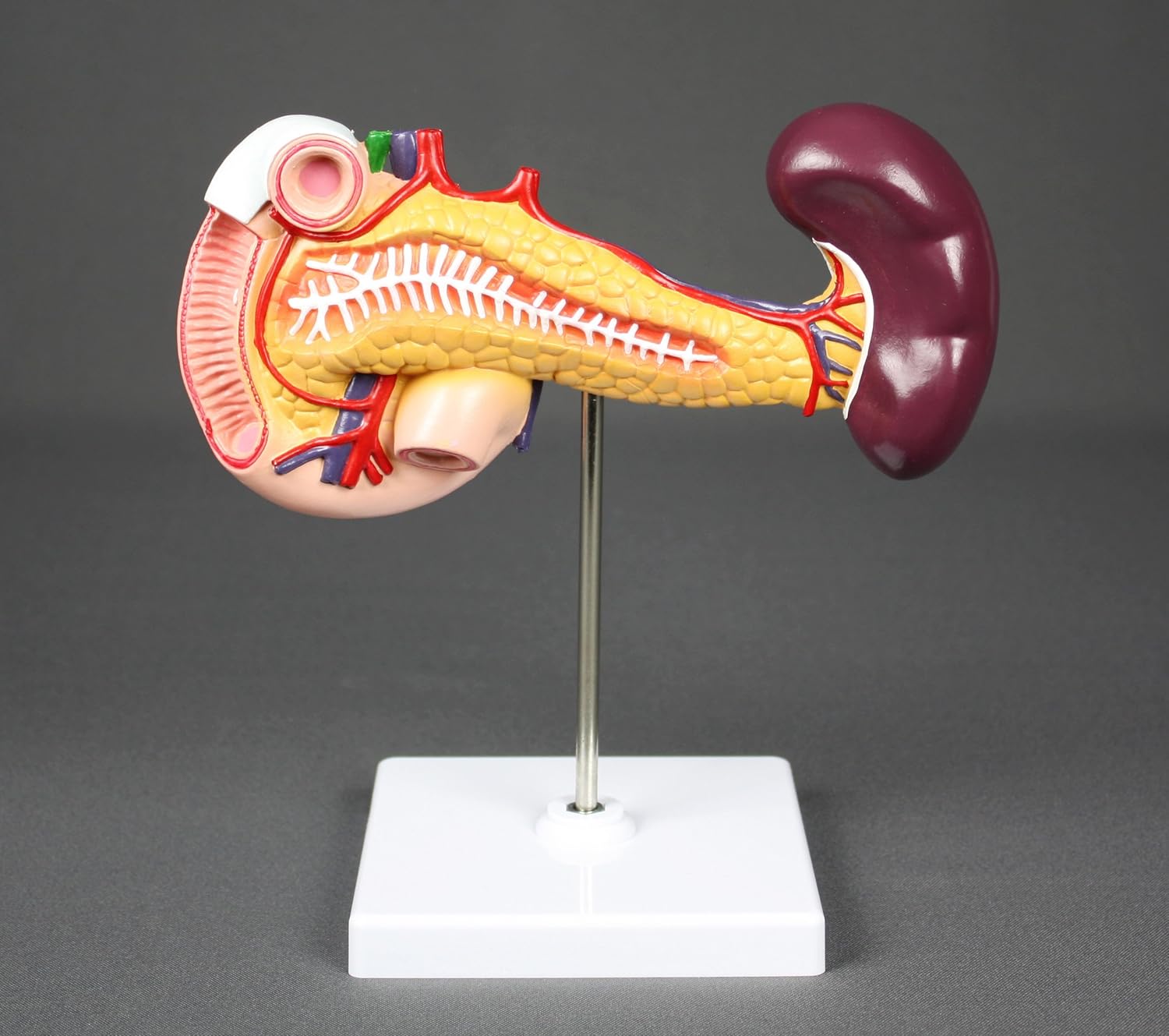 Vision Scientific VAD423-N Pancreas, Duodenum, & Spleen Model