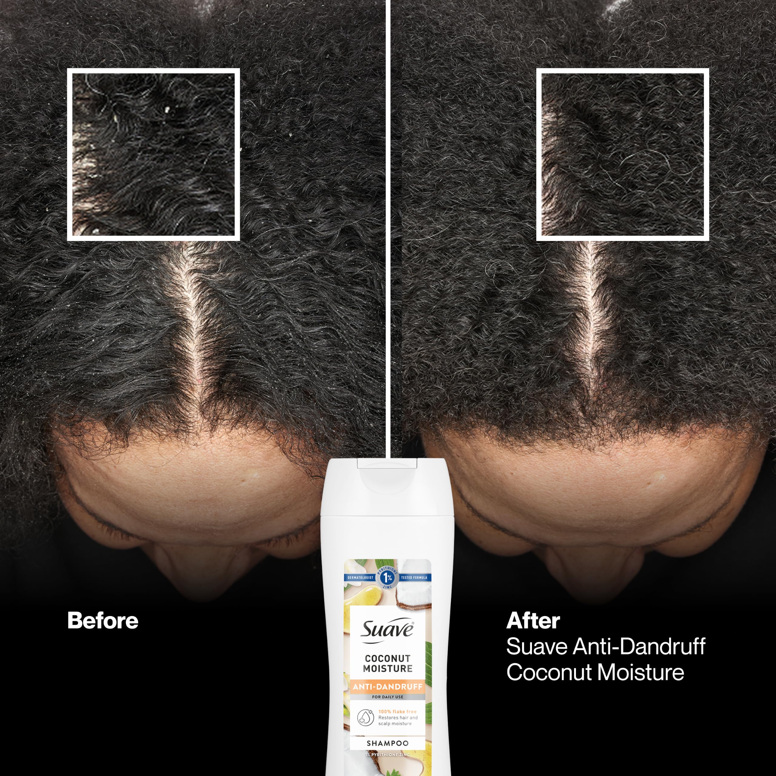 Suave Anti-Dandruff Coconut Moisture Shampoo, 6 Count, 12.6 fl oz