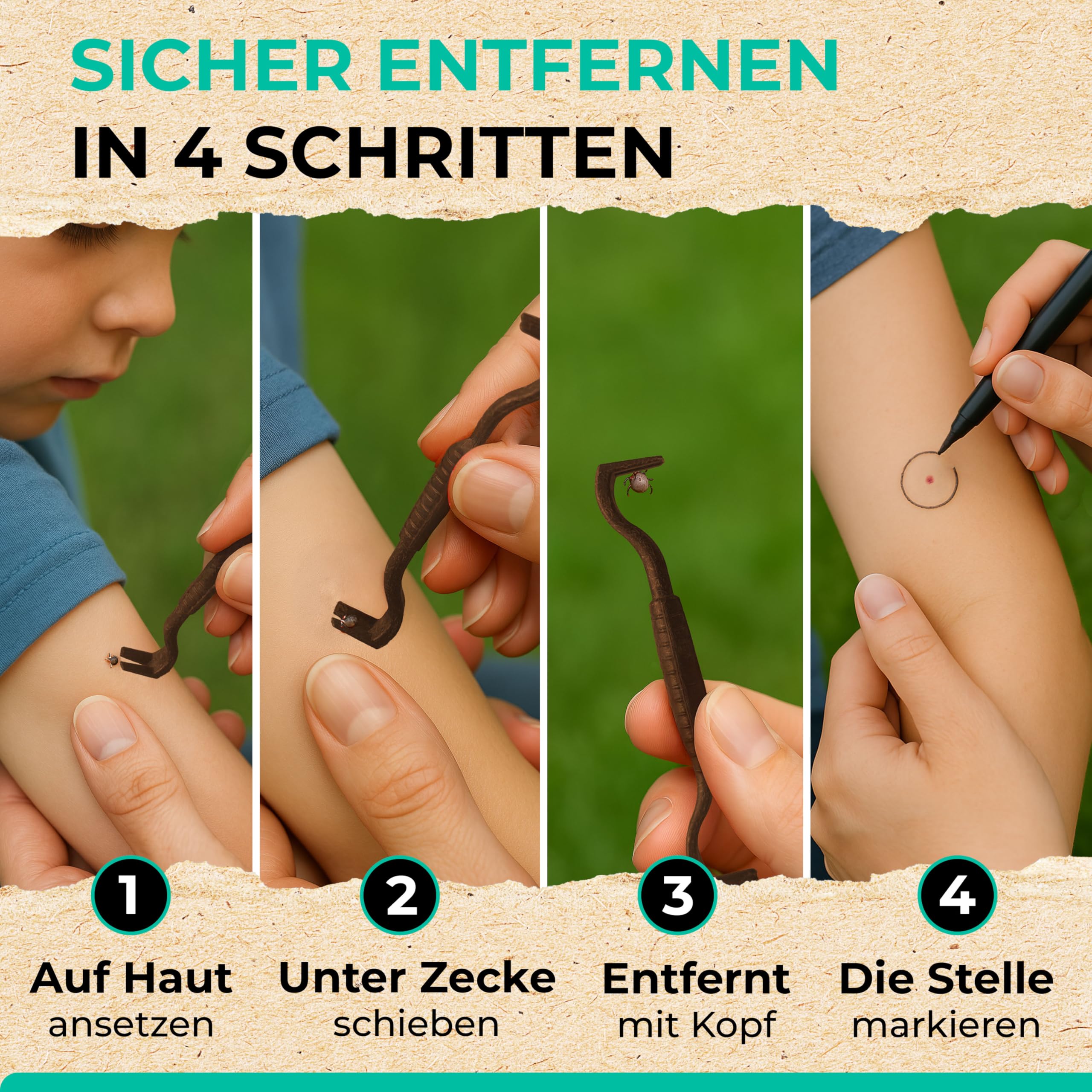 6-teiliges Zeckenentfernungs-Set – Mit Zange, Haken & Lupe, Für Mensch Und Hund, Sicher & Schmerzlos