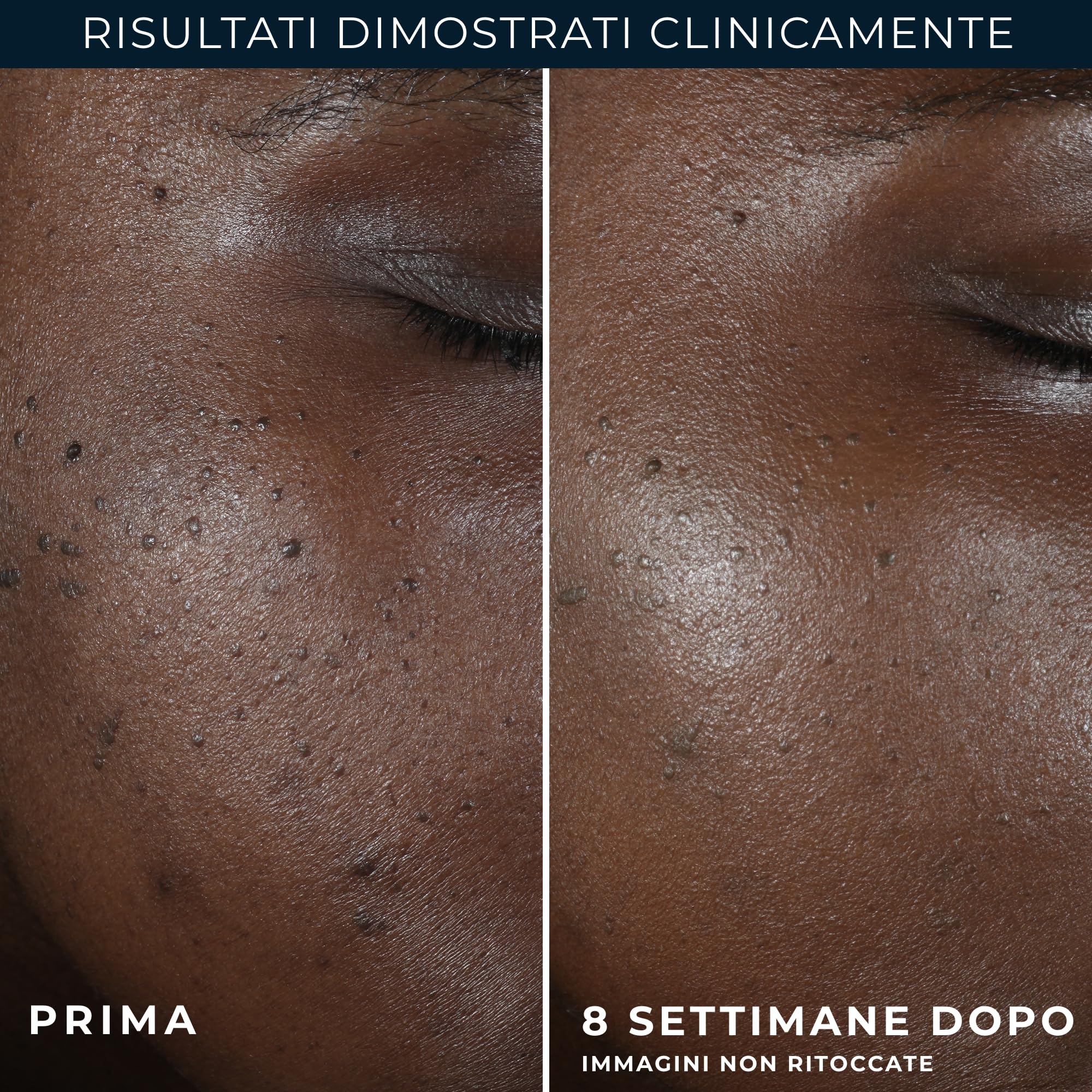 RoC Multi Correxion Crema Notte Antirughe Even Tone + Lift 50 ml
