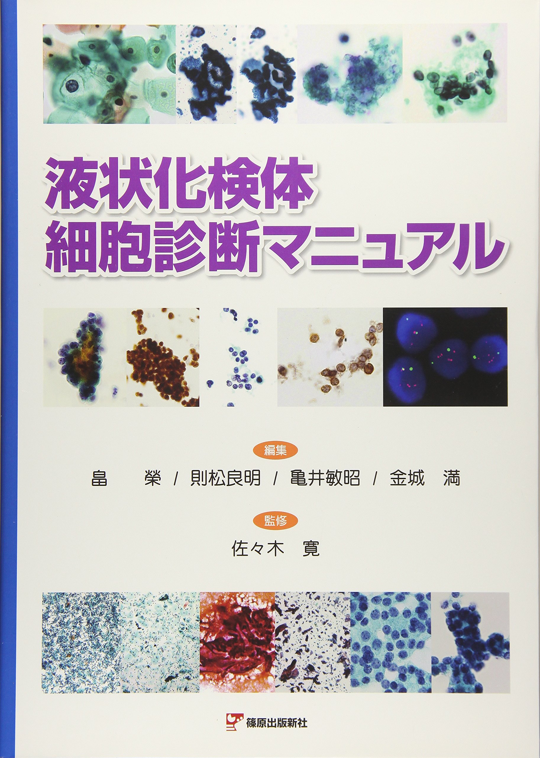 Amazon.co.jp: 液状化検体細胞診断マニュアル : 畠 榮: 本