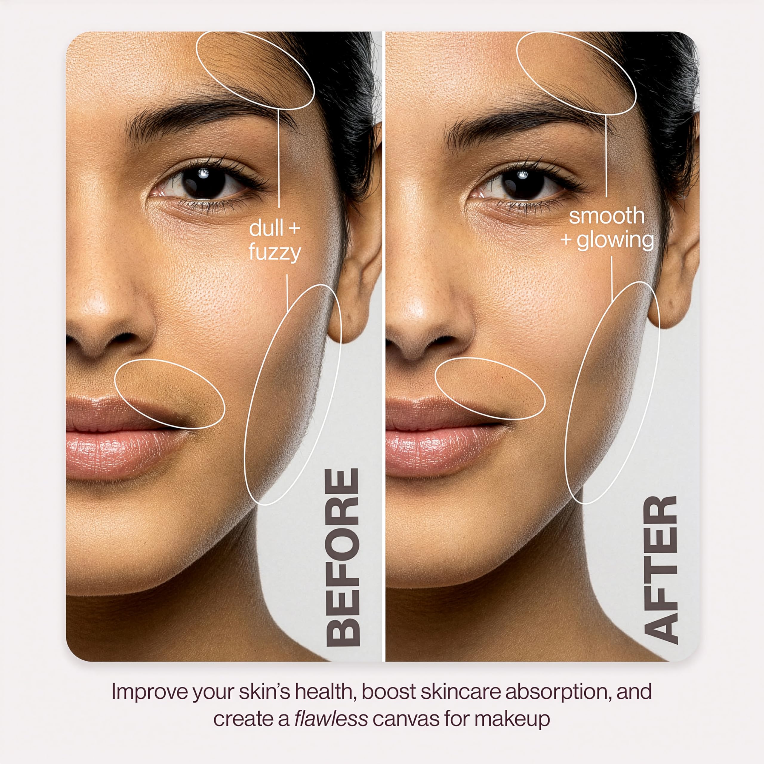 DERMAFLASH Dispositivo LUXE Plus, herramienta antienvejecimiento, exfoliación, depilación y dermaplaning con tecnología Sonic Edge y 4 semanas de tratamiento, rubor