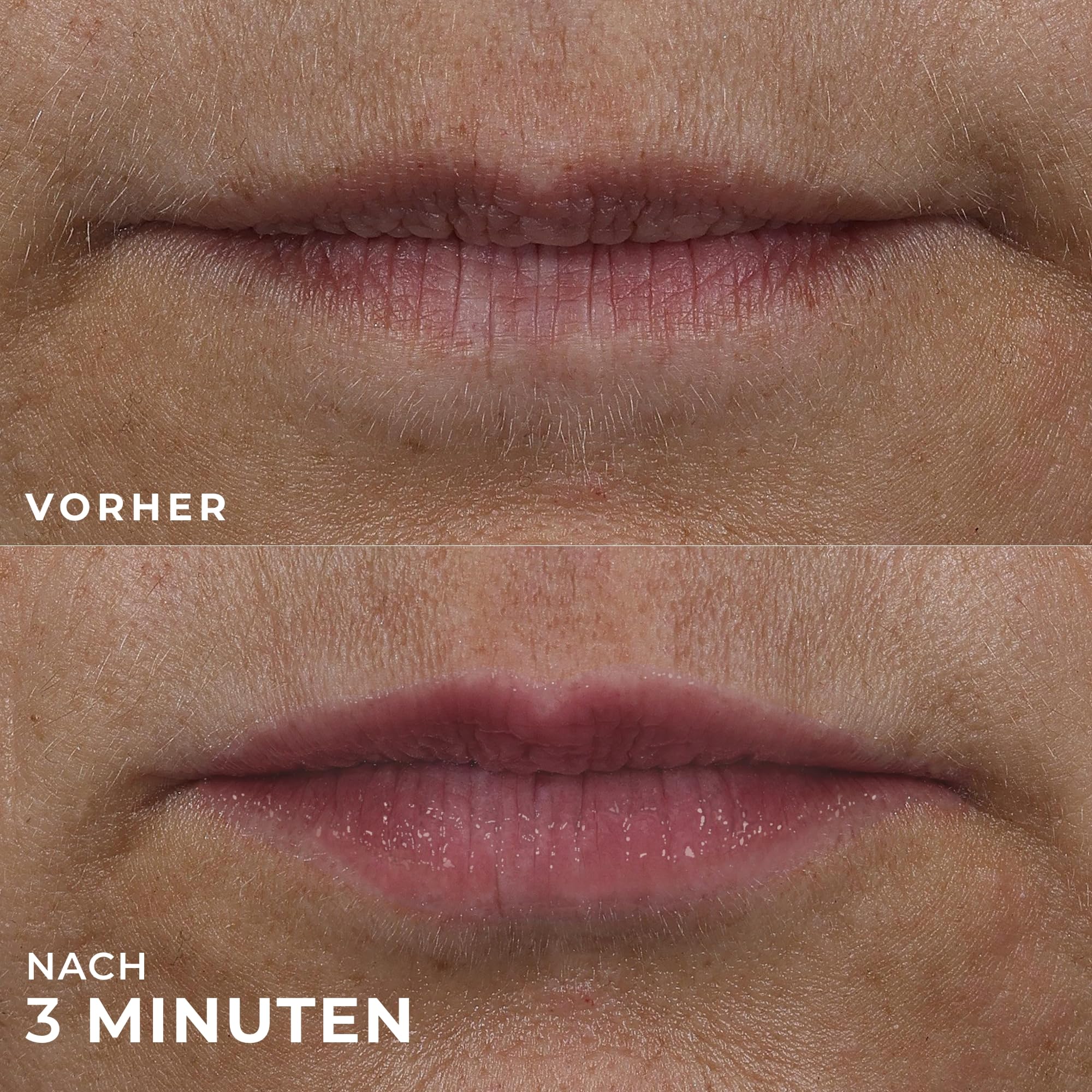 RoC Derm Correxion Lip Volumizer | Lippenbalsam mit Hyaluronsäure & Kollagenpeptiden | 10 ml