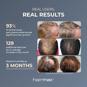 HairMax Ultima 9 Classic LaserComb (FDA Cleared) Hair Growth Device. Stimulates Hair Growth, Reverses Thinning, Regrows Denser, Fuller Hair. Targeted Hair Loss Treatment. | Reverse Thinning Hair, For Men & Women, with 100% Medical Grade Lasers