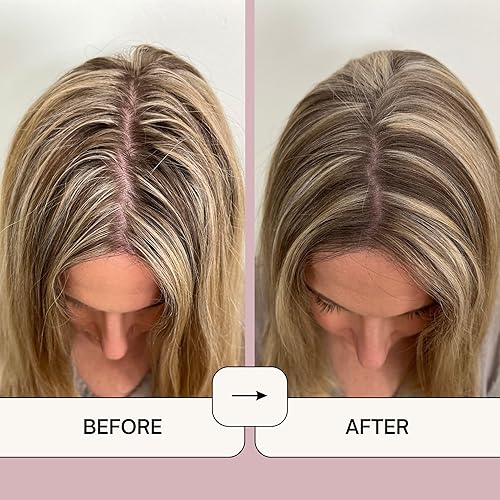 Miniatura 10 de Naturel Champú seco voluminizador en polvo para cabello claro, sin aerosol, fabricado en Estados Unidos, sin benceno, vegano, libre de crueldad