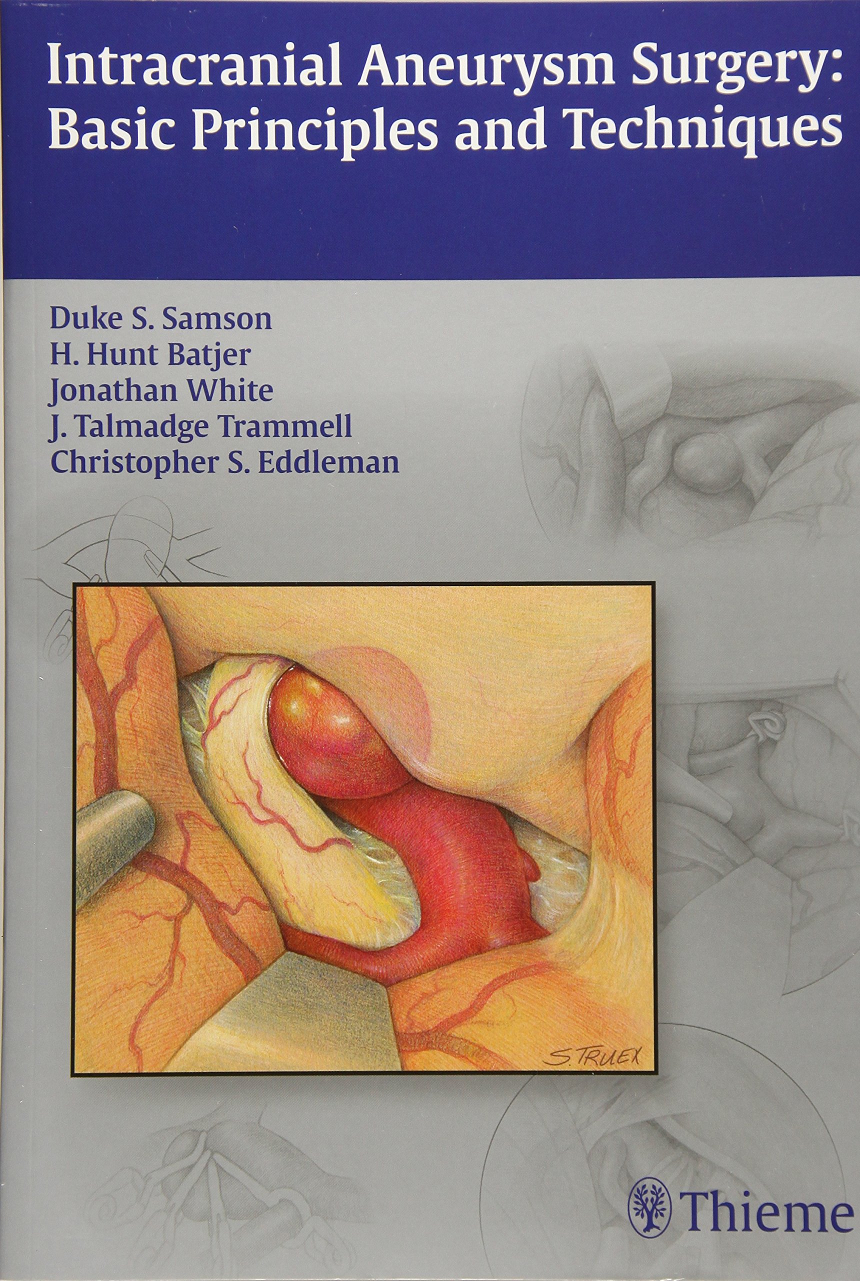 Intracranial Aneurysm Surgery: Basic Principles and Techniques
