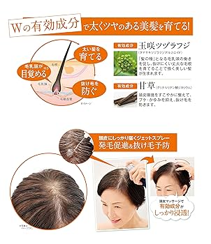 育毛・発毛促進器具 Amazon | スーパーサイヤ 育毛剤 男性用 発毛促進 抜け毛 薄毛