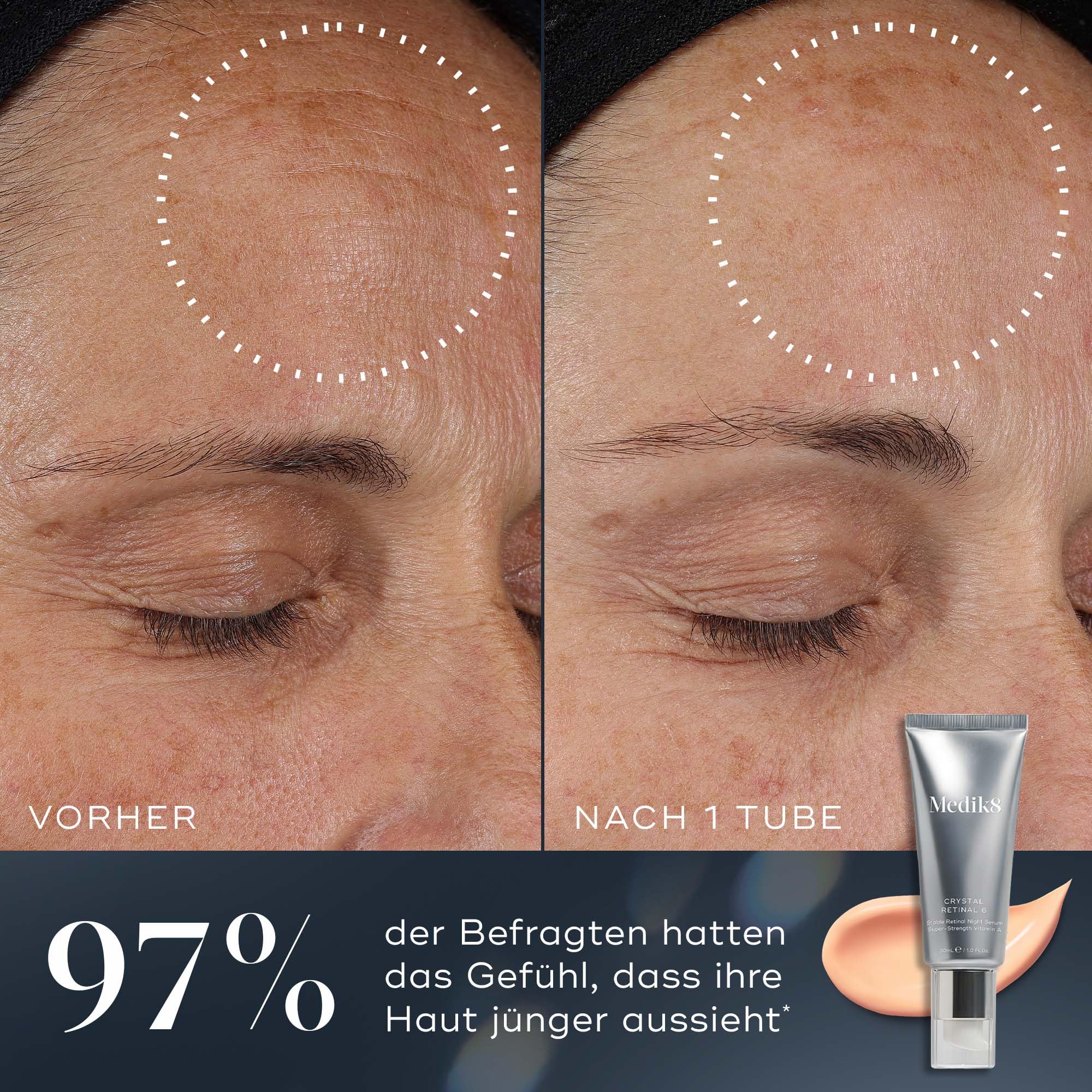 Medik8 Crystal Retinal 3 - Age-Defying Retinal Nachtserum - Verbessert Faltenbild - 0.03% Retinalstärke - 11-mal schneller als Retinol - Für neue Vitamin-A-Anwender - 30ml