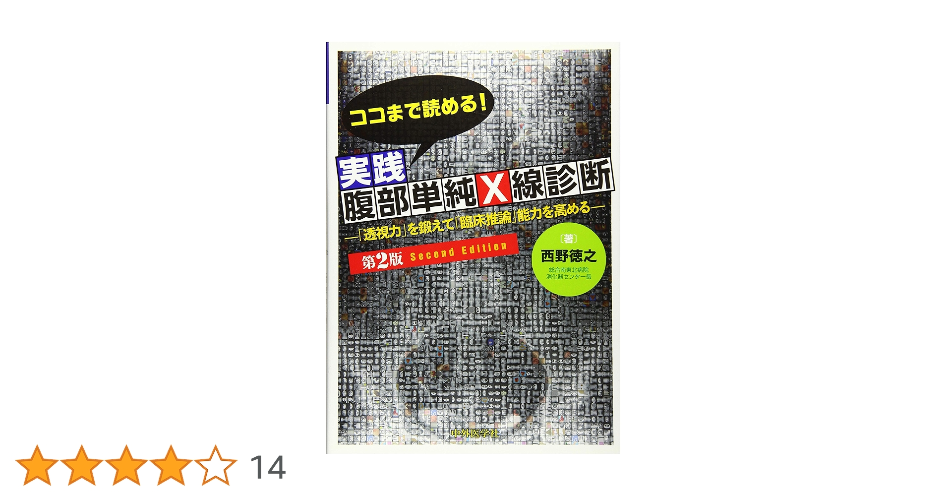 ココまで読める！実践腹部単純X線診断 2版 | 西野 徳之 |本
