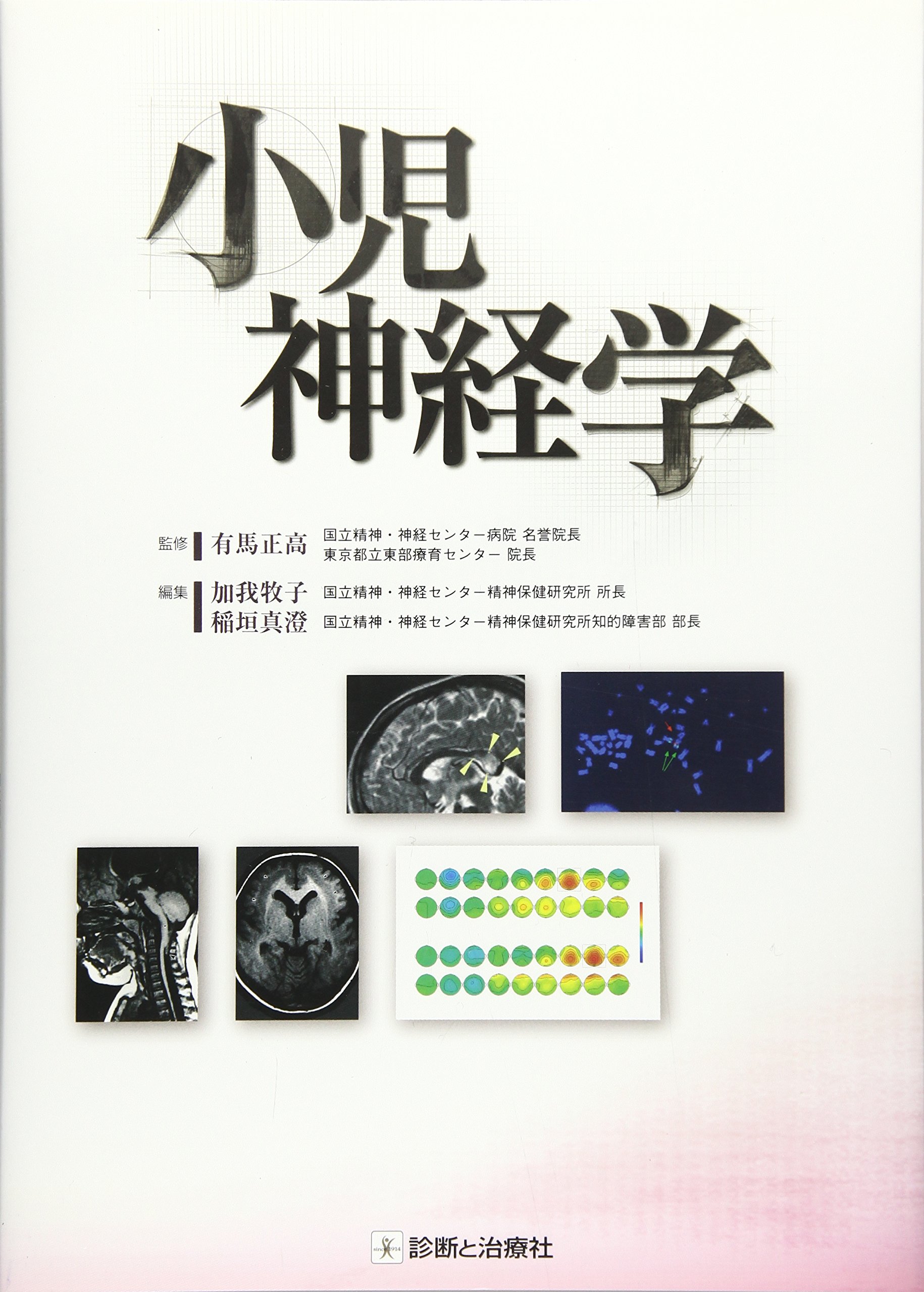 小児神経学の進歩 第２５集/診断と治療社/日本小児神経学会（単行本） 小児神経学の進歩 第25集/診断と治療社/日本小児神経学会