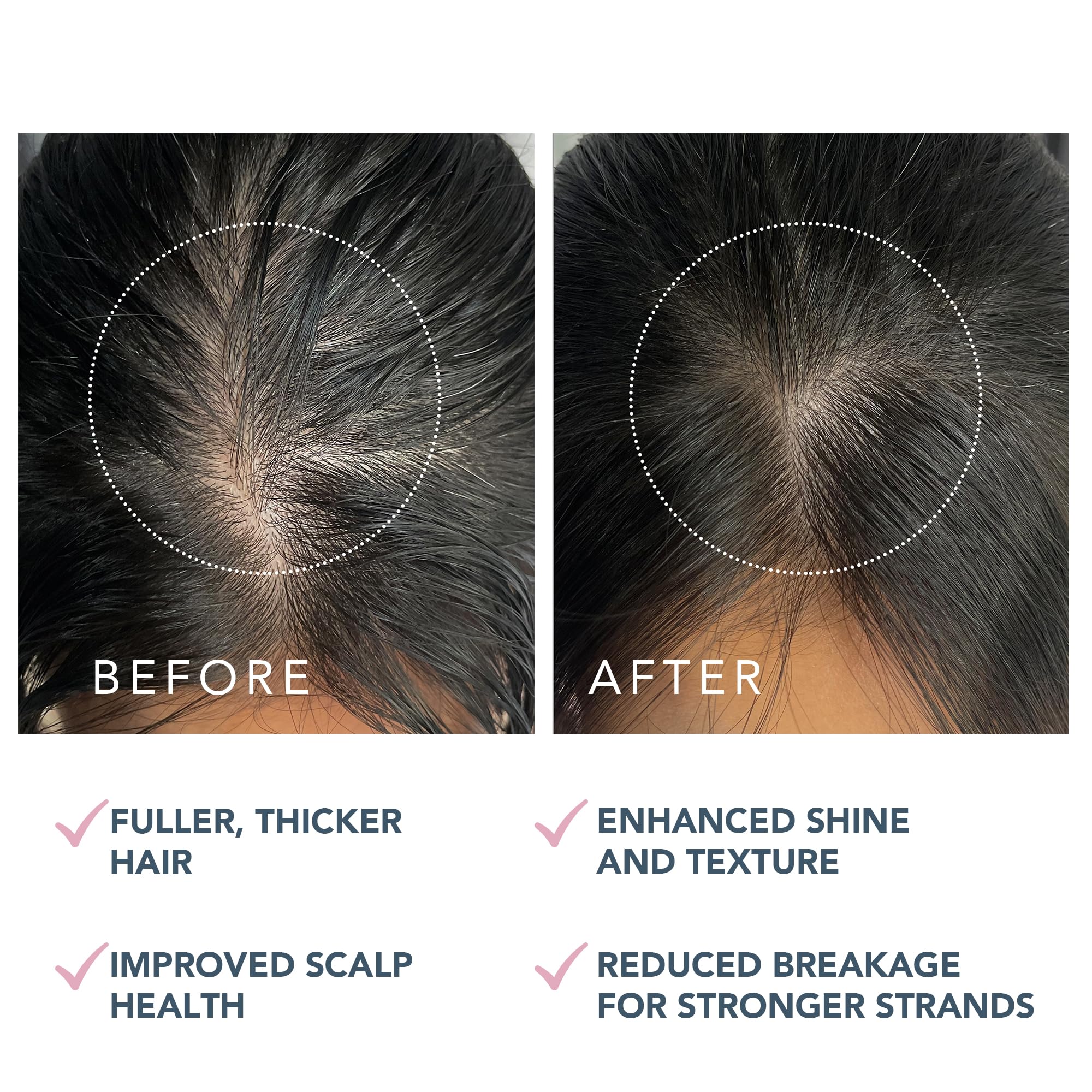 FOREO LUNA Dual-Peptide Scalp Serum – Hair Growth & Scalp Treatment with Cica and Portulaca Extract – Hair Serum for Growth, Thickening, and Hair Loss Treatment – 2 fl. Oz