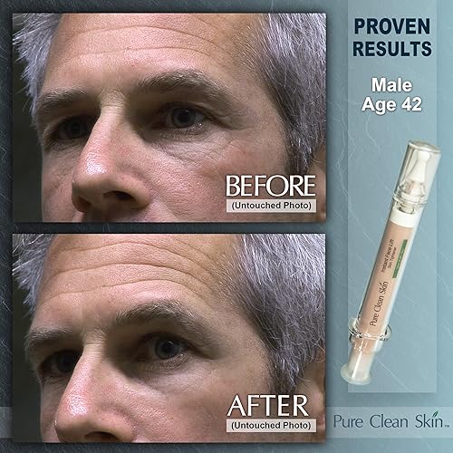 Miniatura 6 de EUZEN - Crema para apretar la piel para la cara – Obtén un estiramiento facial instantáneo en 3 a 5 minutos – esta crema antiarrugas para ojos