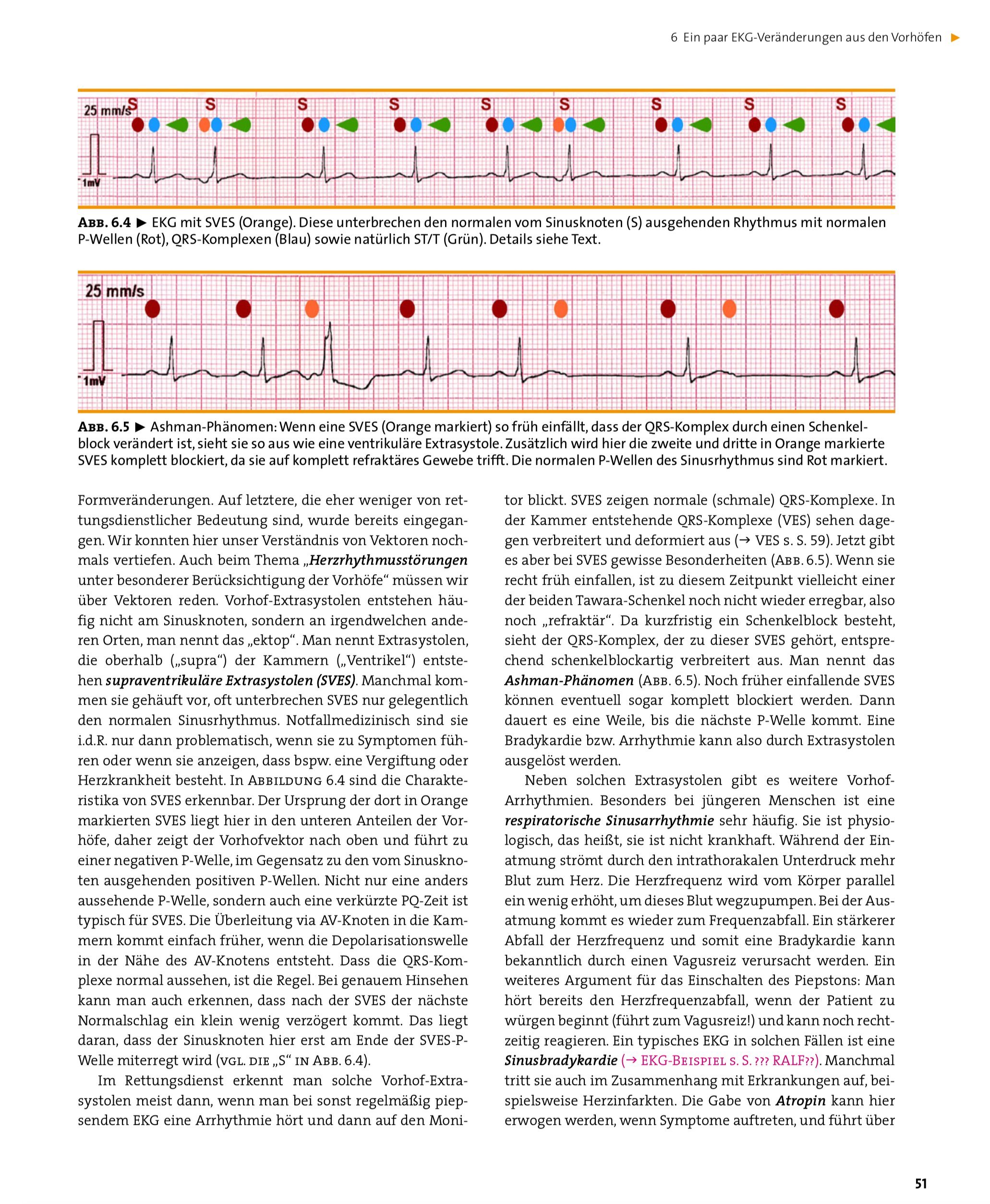 EKG in der Notfallmedizin: Grundlagen – Auswertung – Therapie