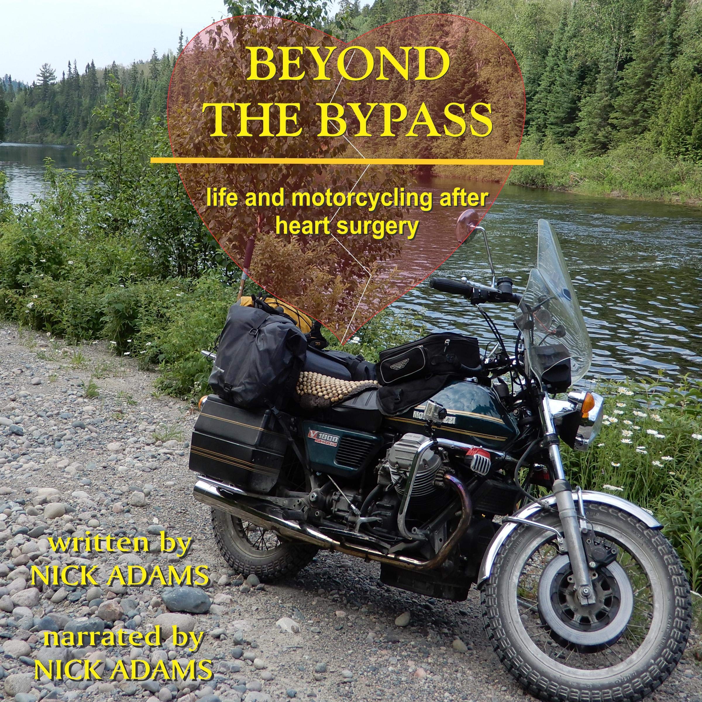 Cover art for Beyond the Bypass