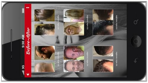 Spare My Hair Pro