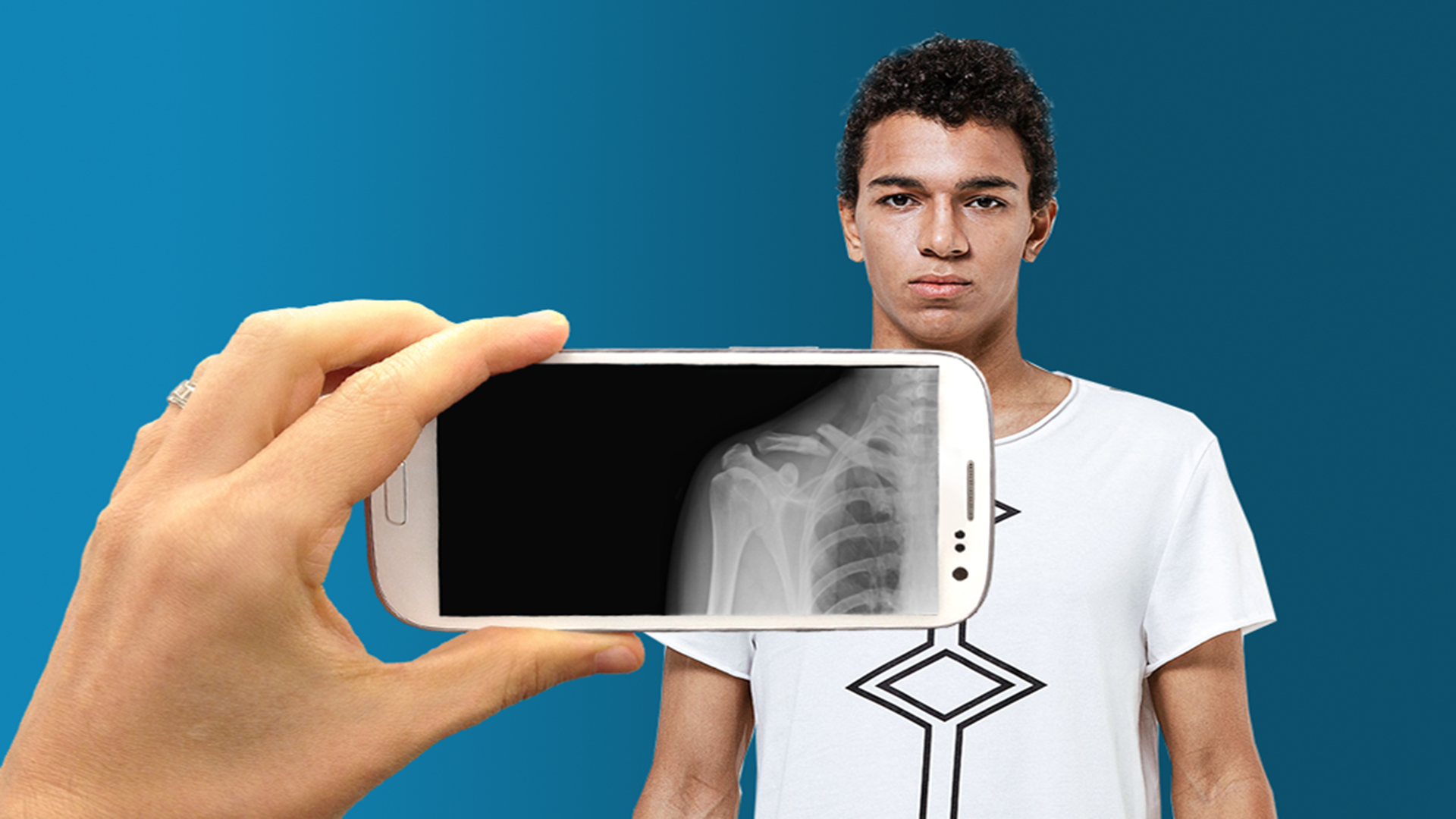 Broken Bones for Android