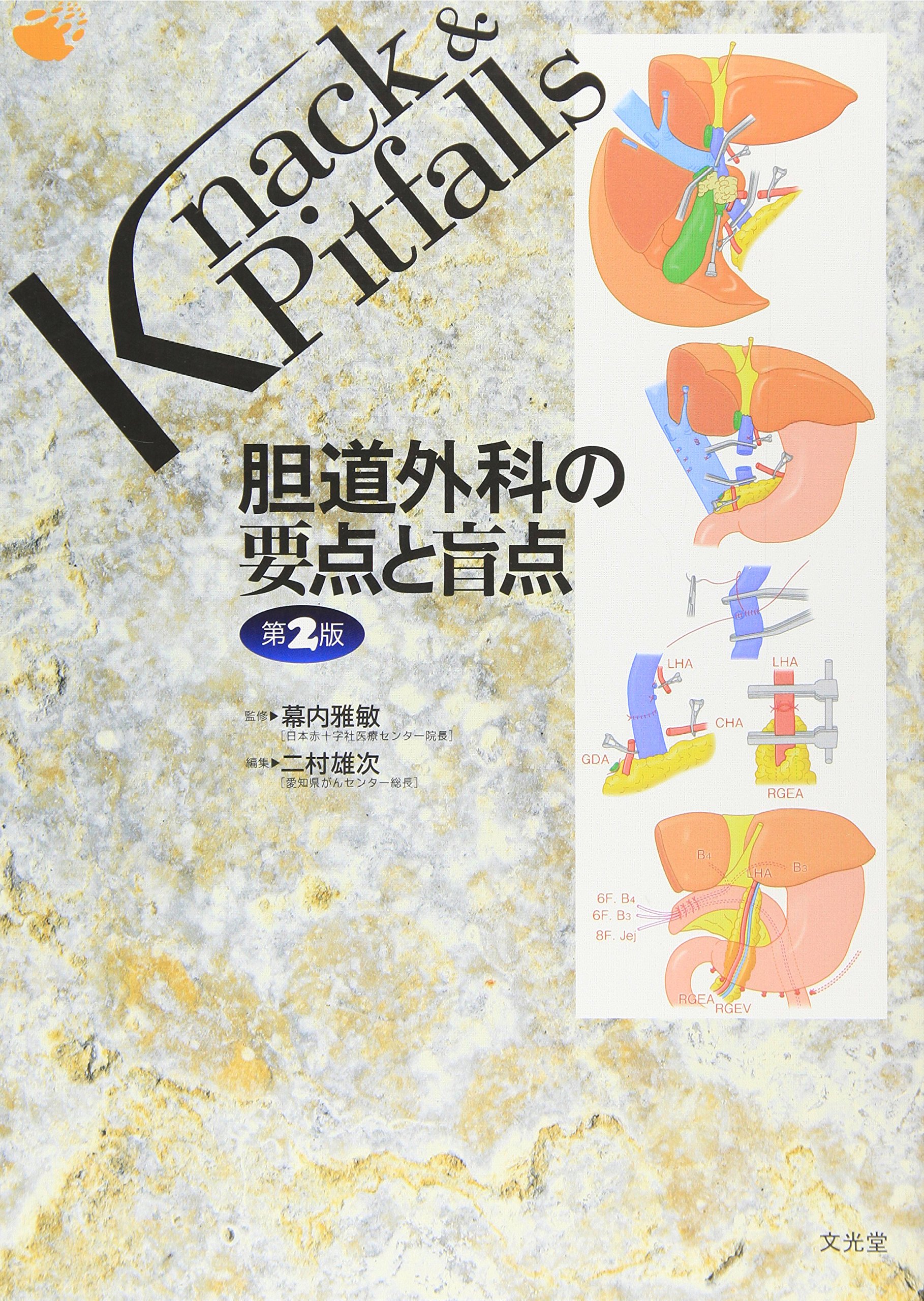 Amazon.co.jp: 胆道外科の要点と盲点 (Knack & pitfalls) : 二村 雄次: 本