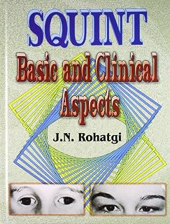 Squint Basic And Clinical Aspects
