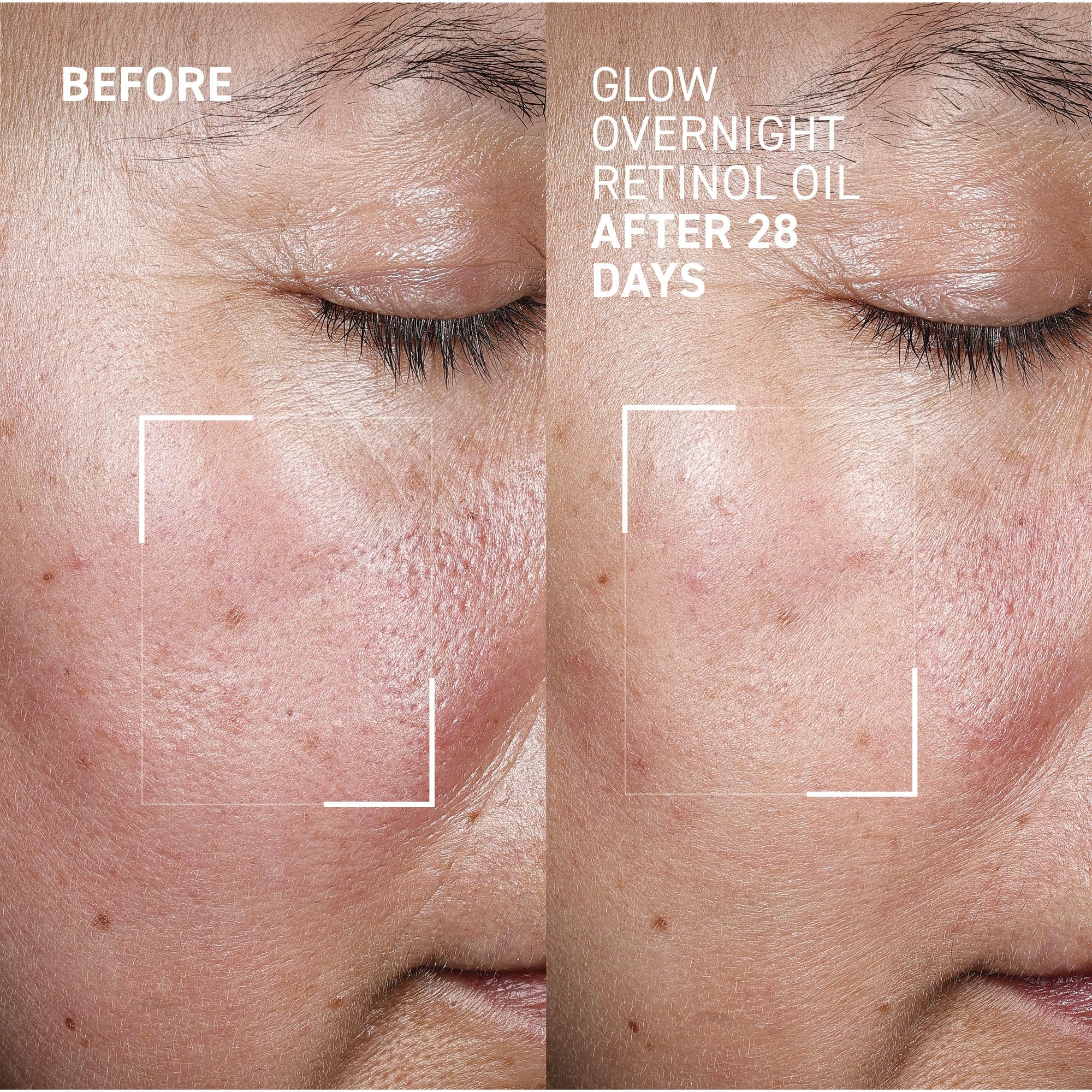 Dr. Brandt Bright This Way Glow Overnight Retinol Oil - Pure 2% Retinol Improves Wrinkles, Lines & Skin Texture - 30 mL - Image 2
