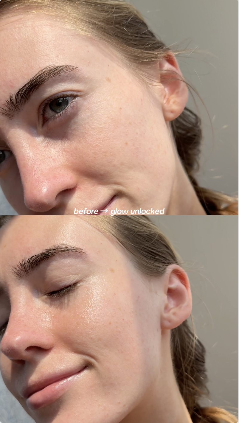 Amazon.com: Medature PSL Repair Moisturizer II-Daily Moisturizer