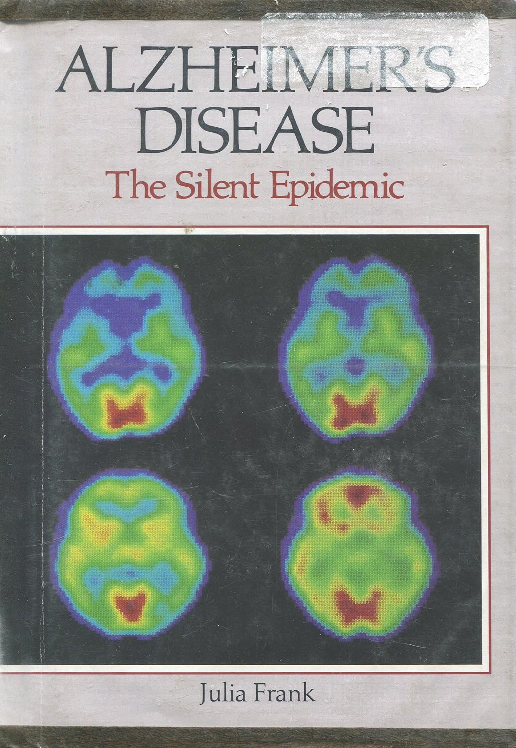 Alzheimers Jack Nicholsons Legacy And The Diseases Silent Toll - djc365u