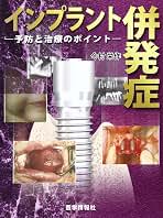 Amazon.co.jp: インプラント併発症: 予防と治療のポイント : 今村 栄作: 本