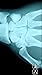 Xray Scanner