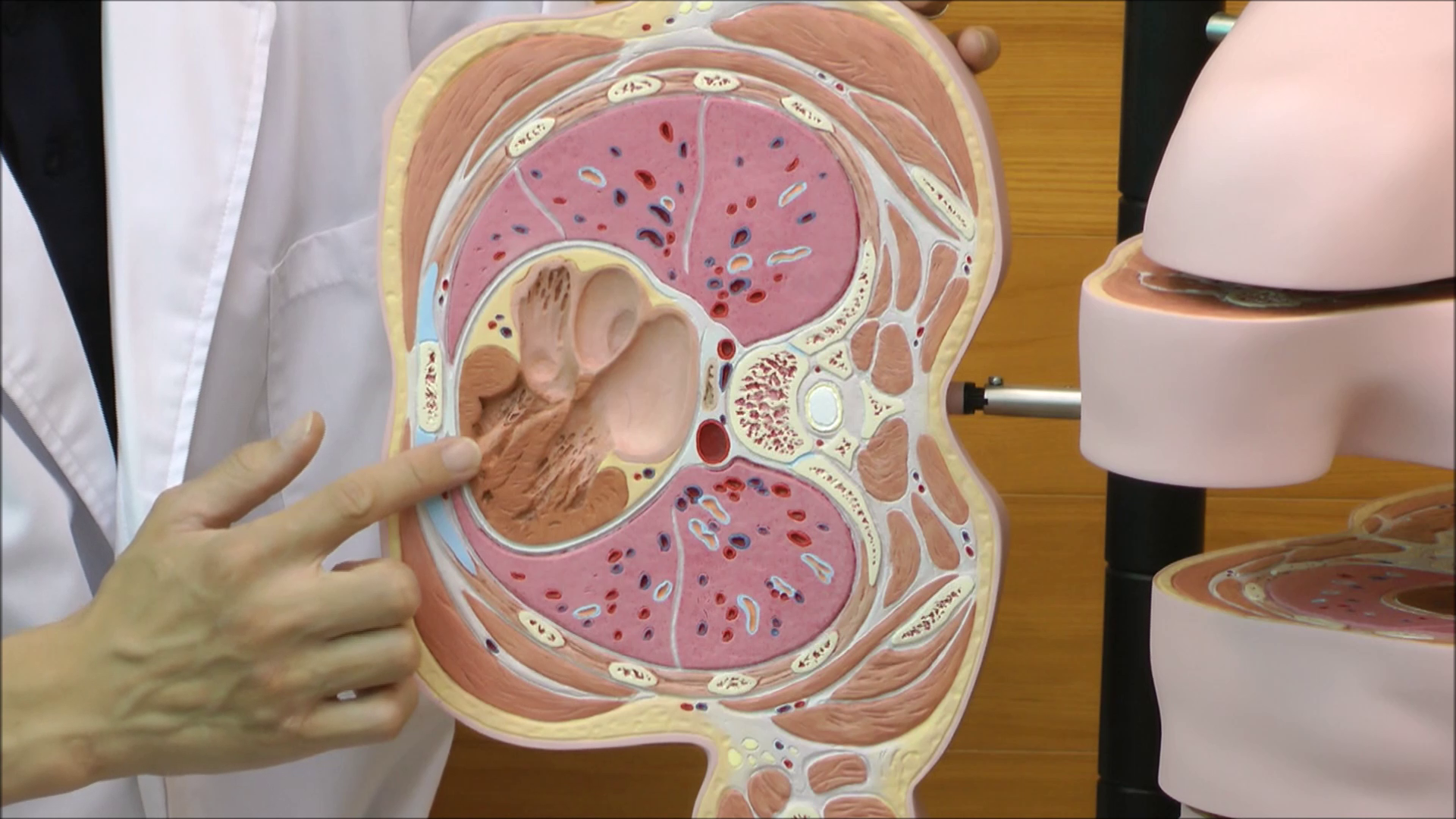 Amazon.co.jp: ディスクトルソー，15横断モデル - 3B Scientific